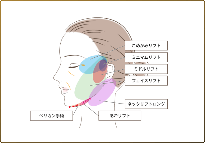 術式比較グラフ