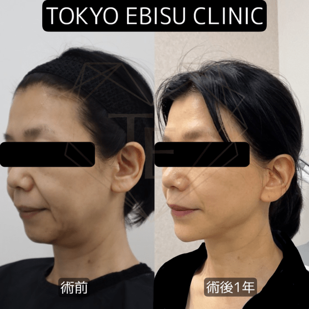 症例写真1