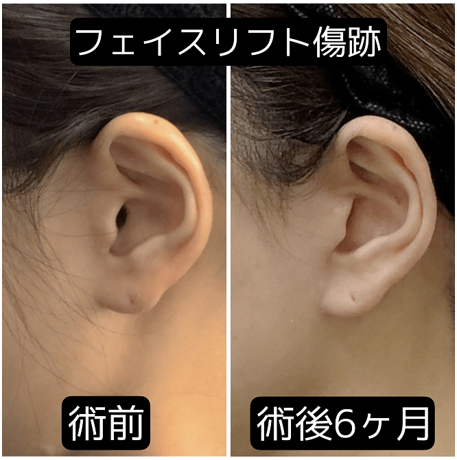 症例写真2