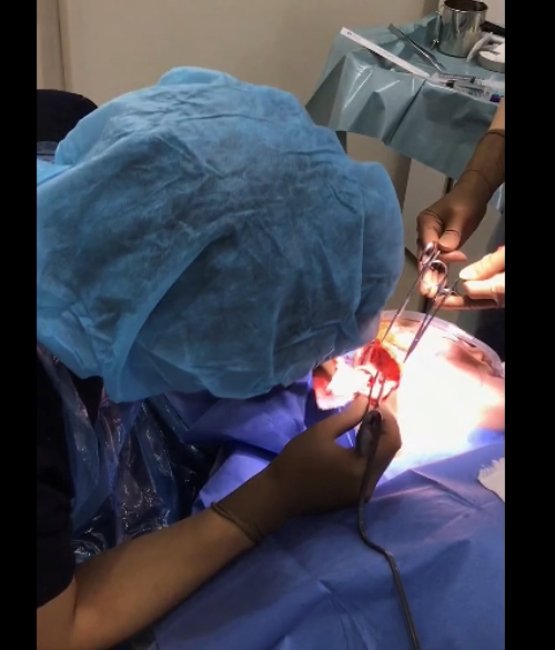 フェイスリフト