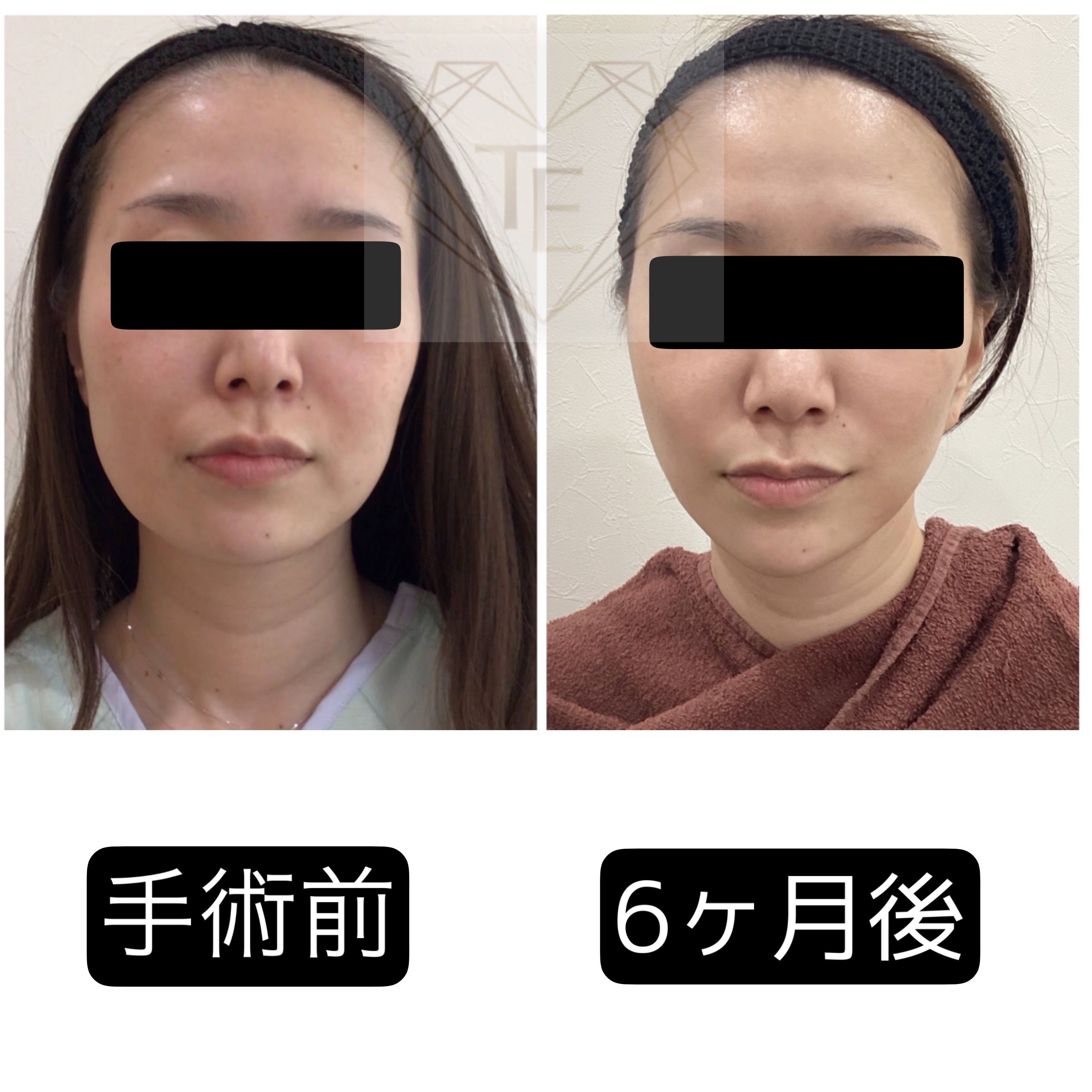 818d75b3-e290-40b4-900a-b956923ea673