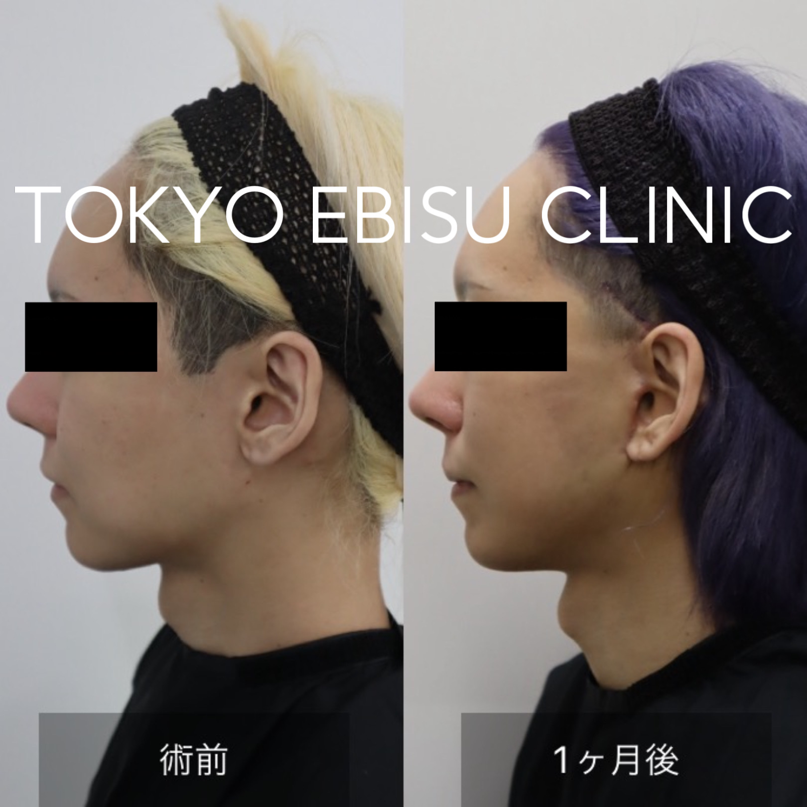 00ADD589-E86D-4CB2-95ED-27F398750B26