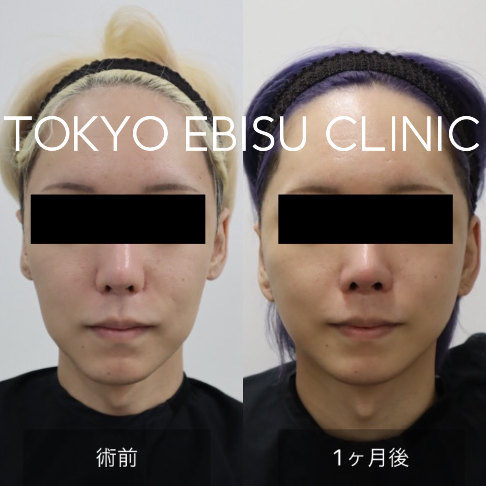 A2EAD36C-34CB-45EA-AAB0-4A2719B3075E