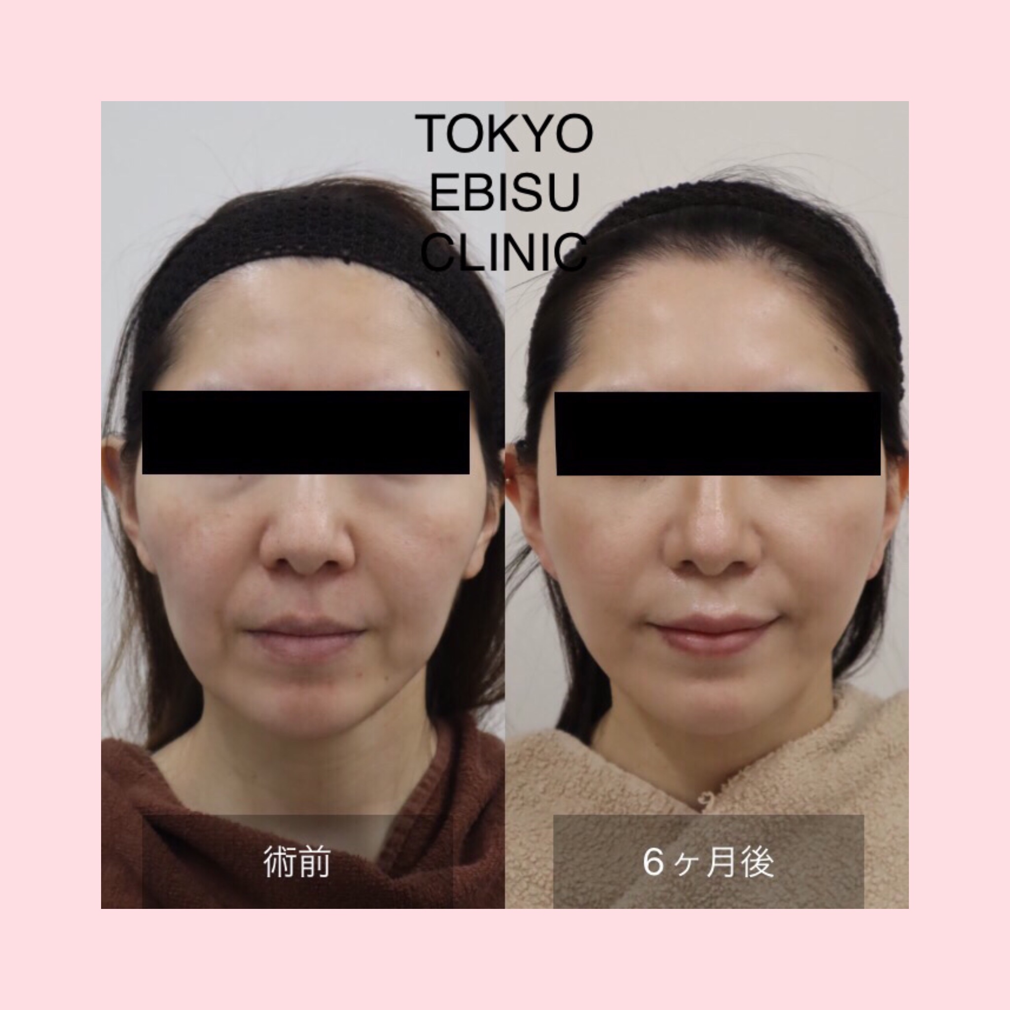 photo-output-1