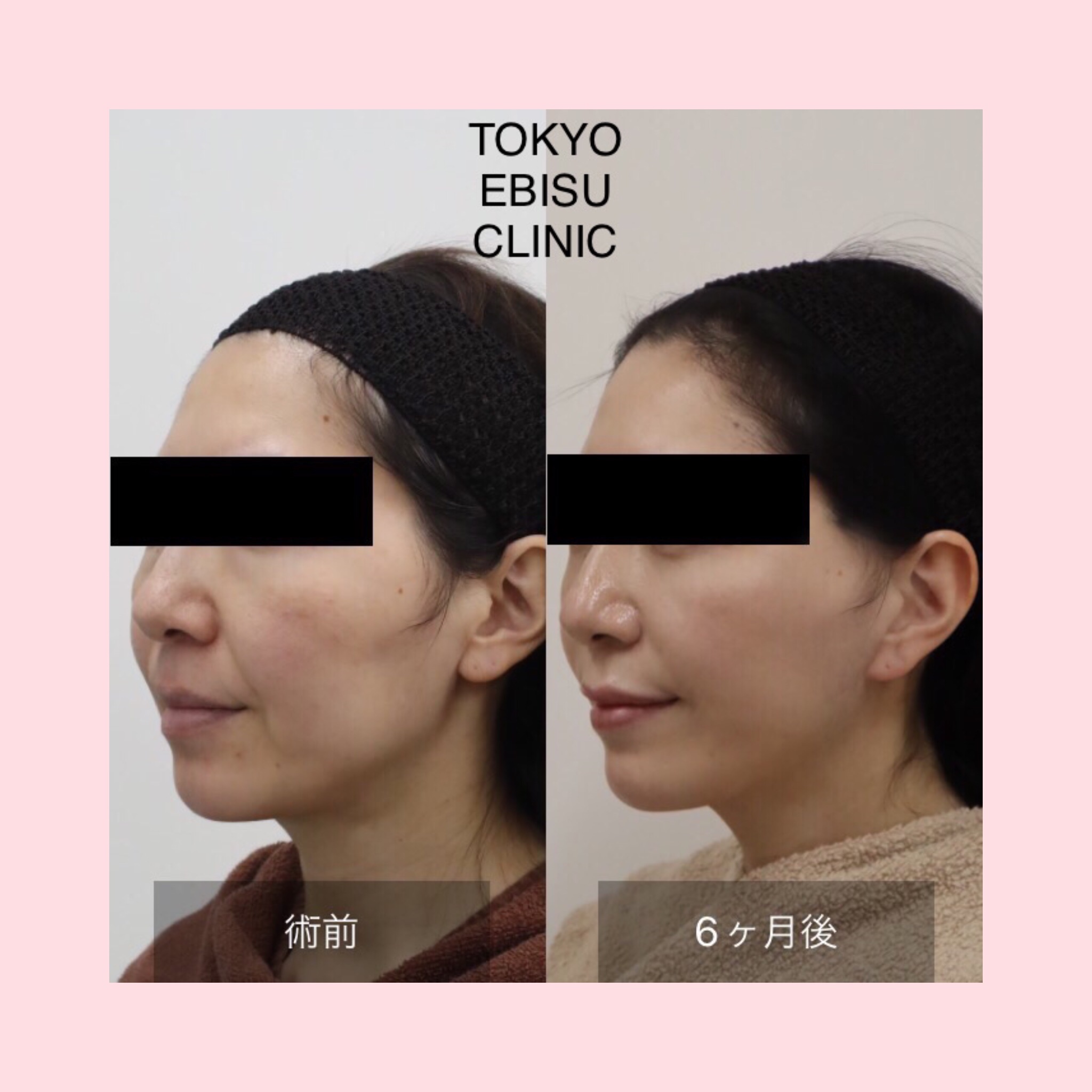 photo-output-2-1