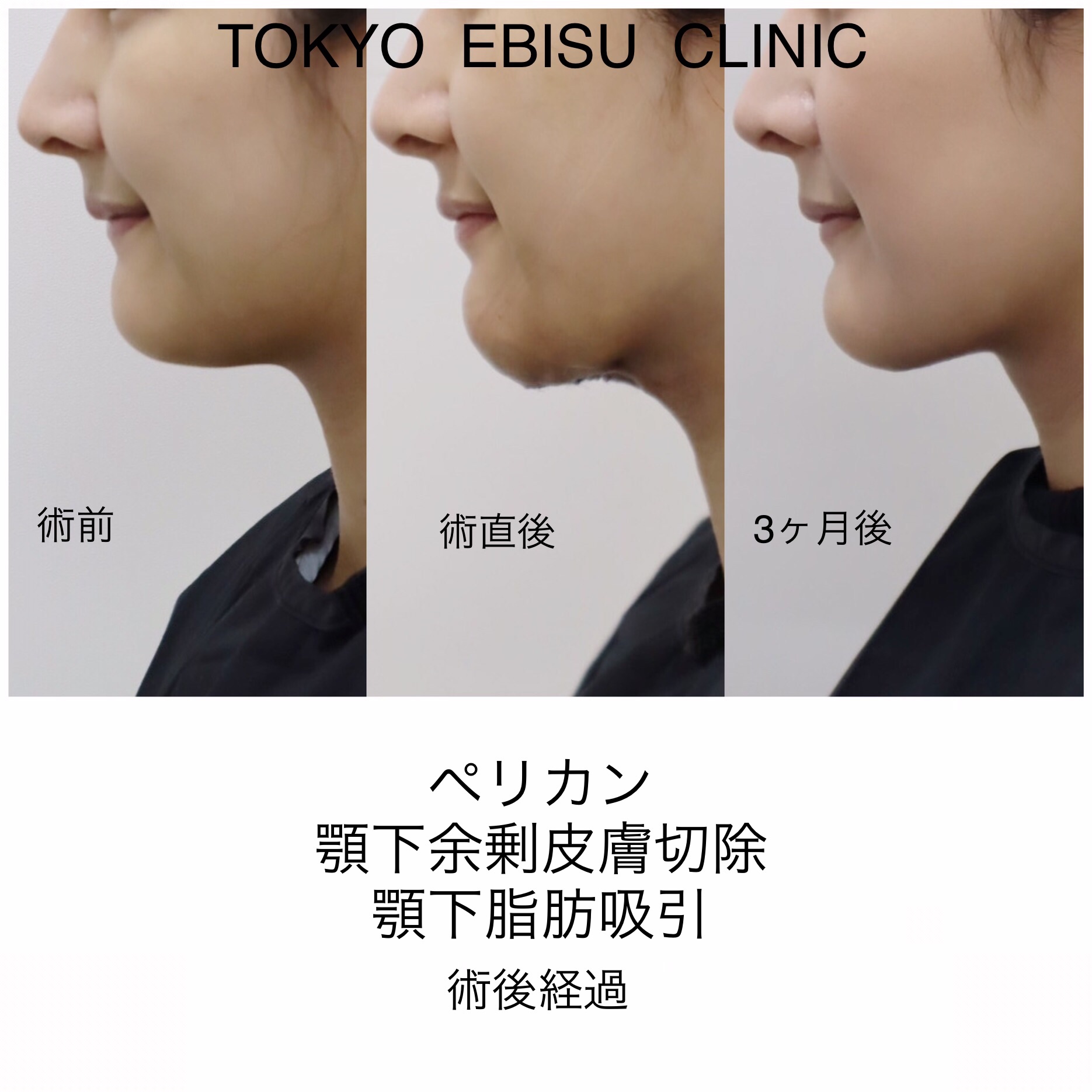 photo-output-1