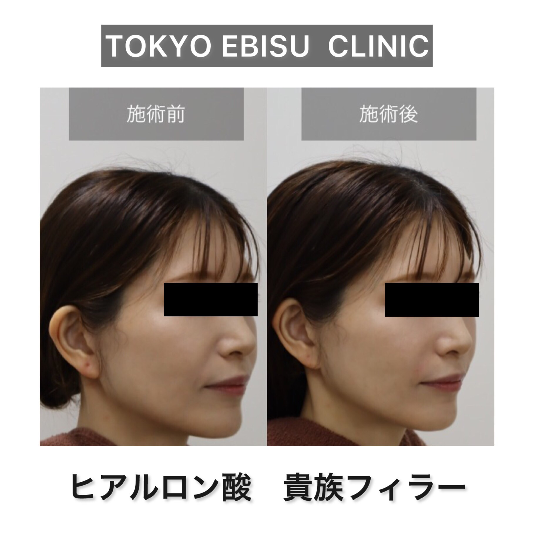photo-output-1-2