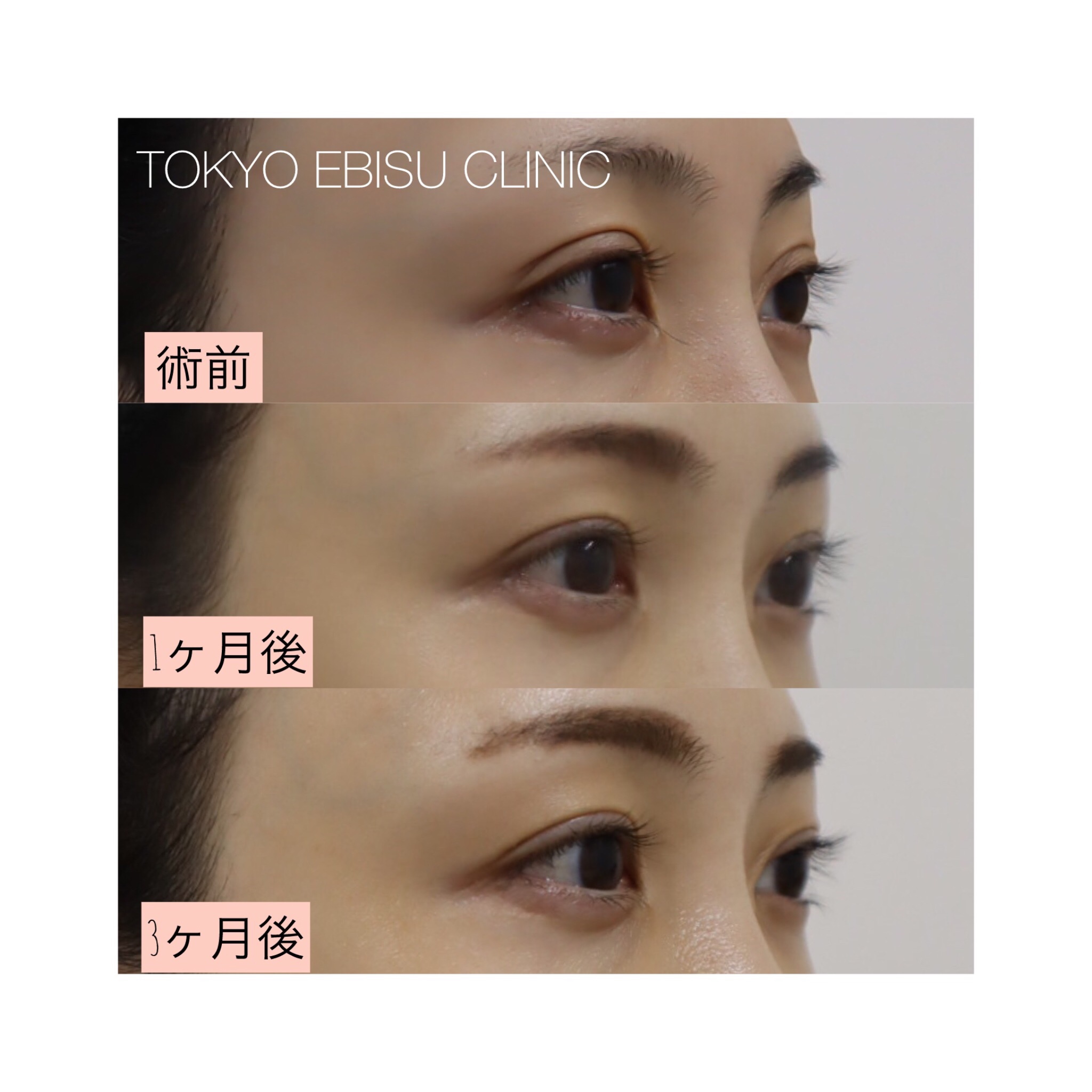 photo-output-2-1