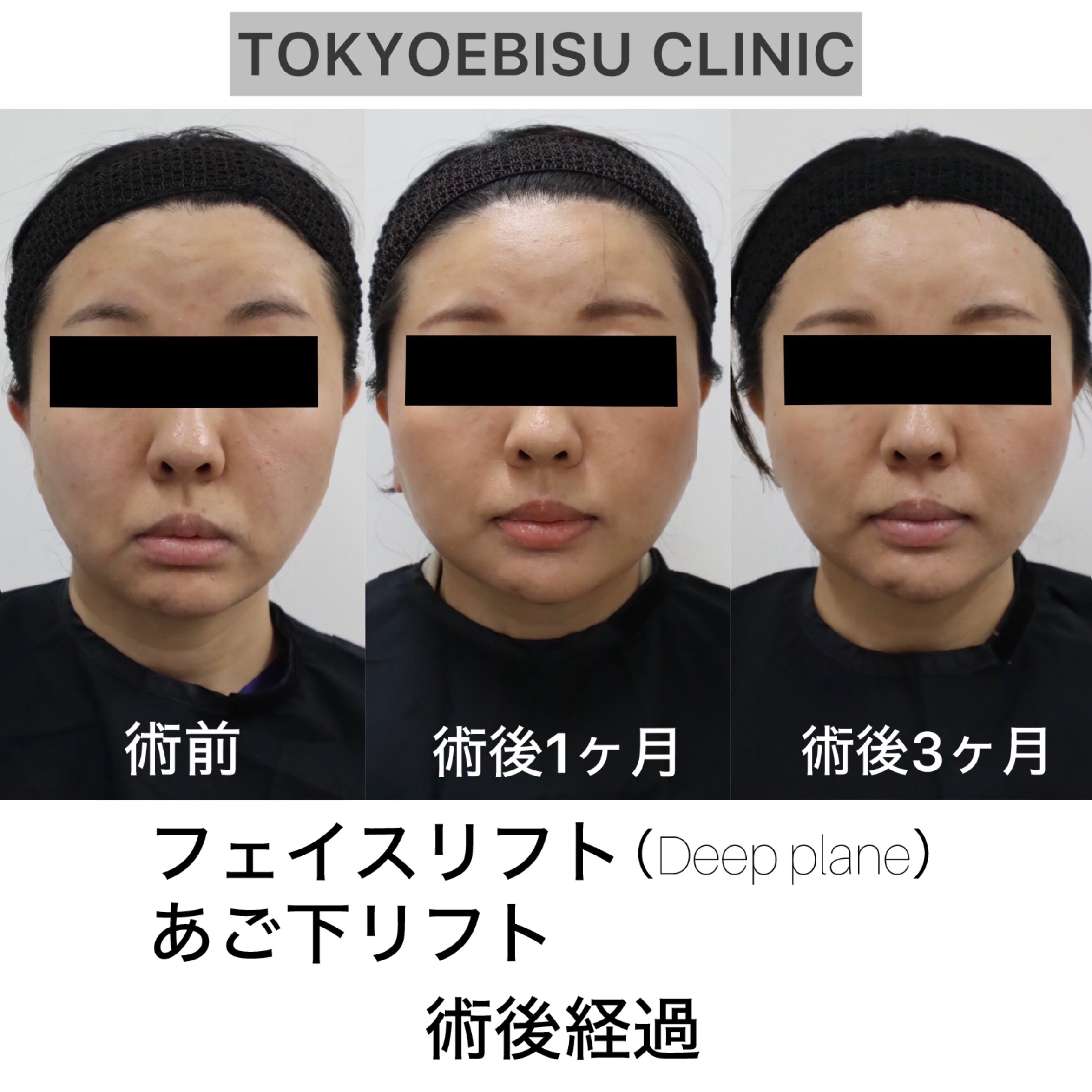 095bf763-da0e-4d2b-a76a-5eac6f4b5b0e-1-1