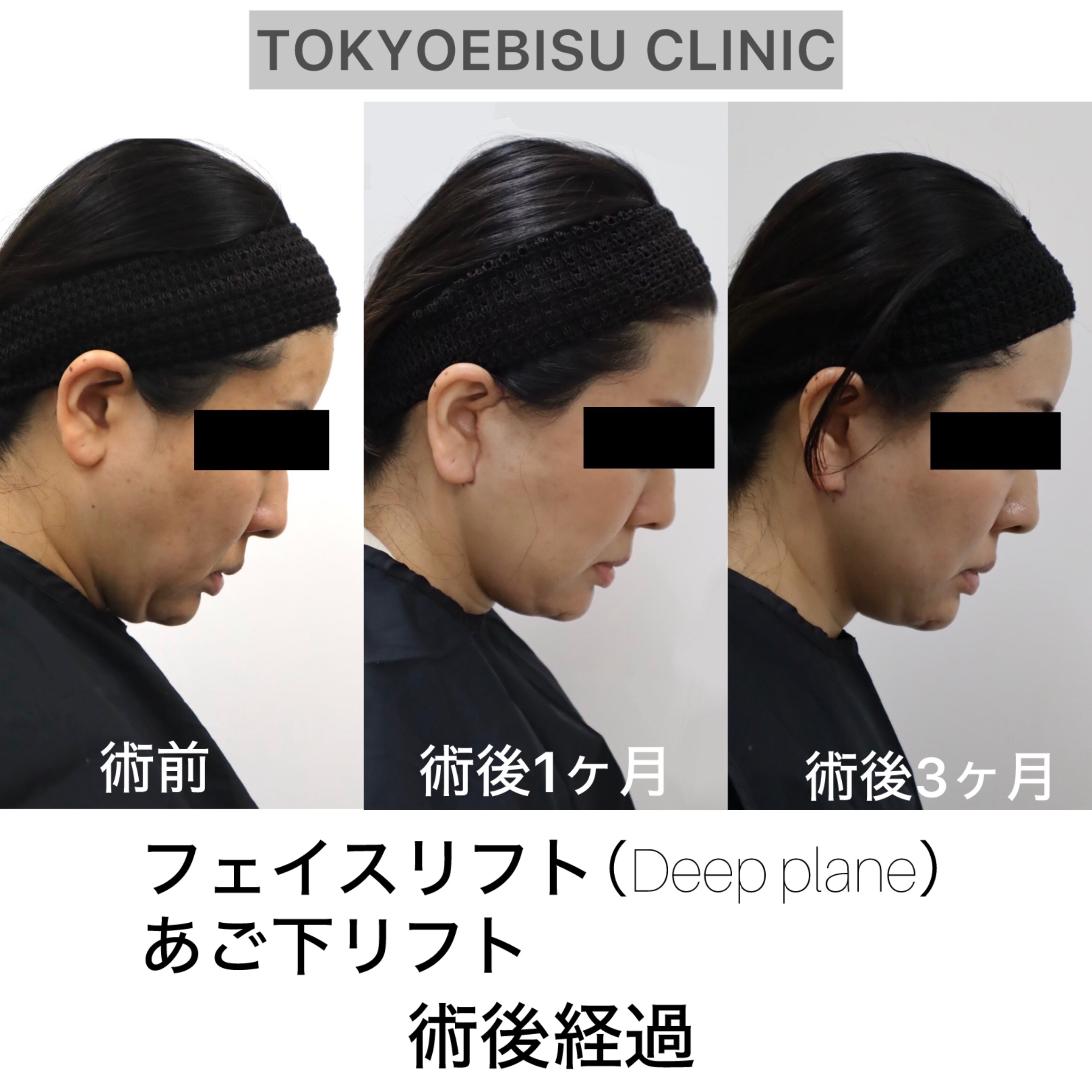 photo-output-1-1