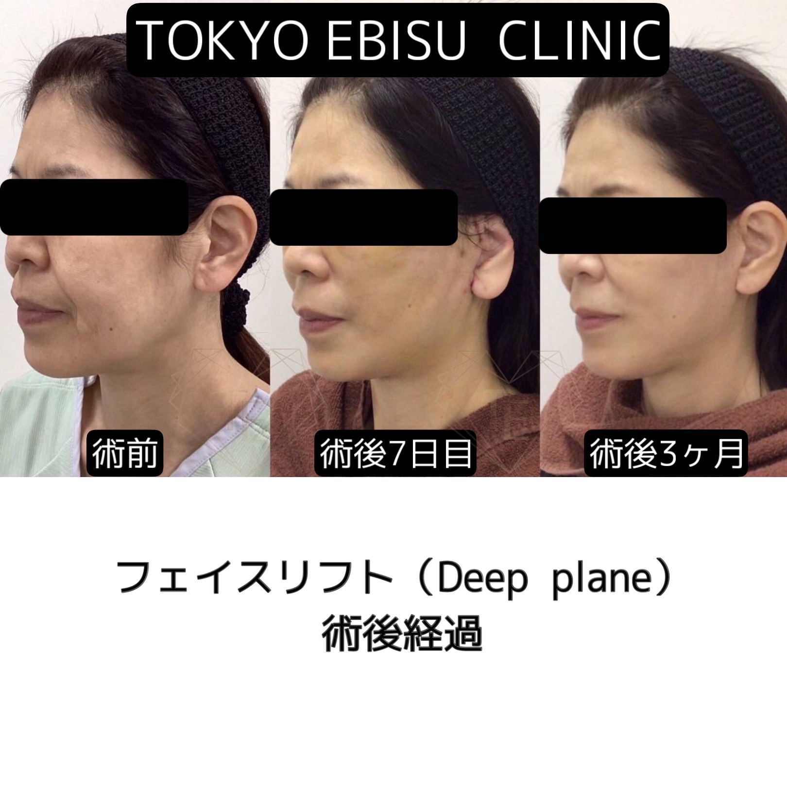 602EE54C-1966-49FF-A9C7-ABA80D86AB7C