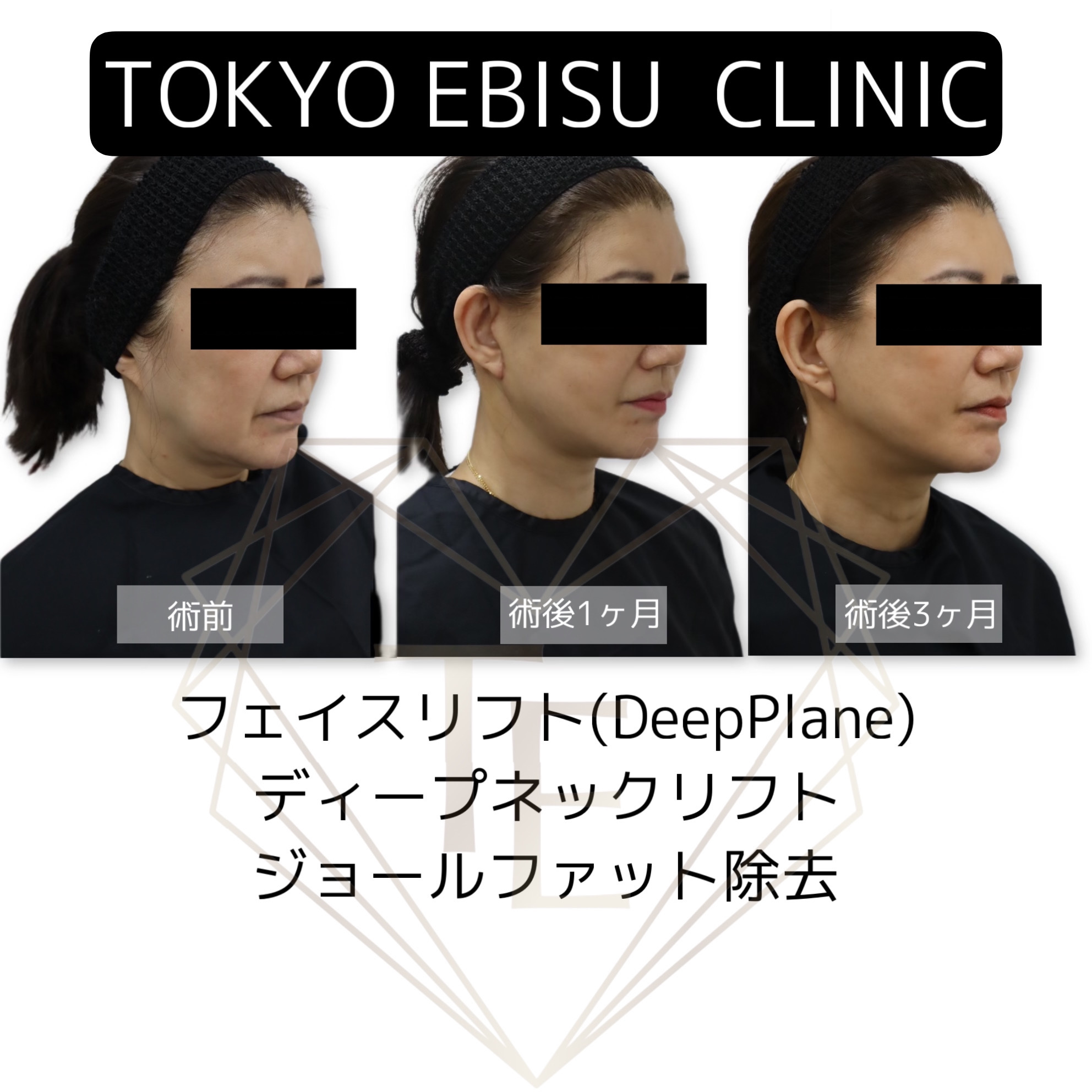 BD126DA6-6AB4-492E-B1A7-98B1181972EB