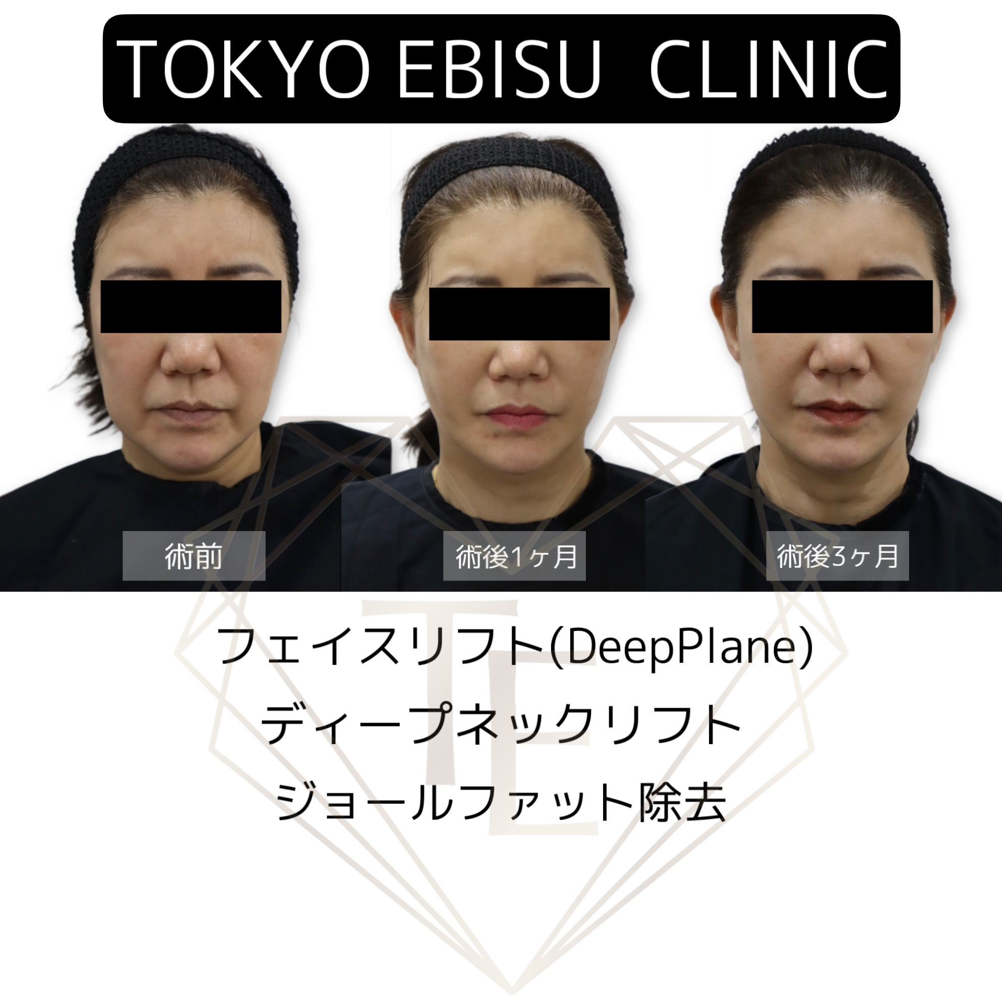 F73DFBEA-727C-49BF-8288-2D07622F6C12