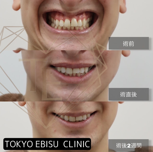 b39bce19854e1b7c1f8c6eec9d58175e