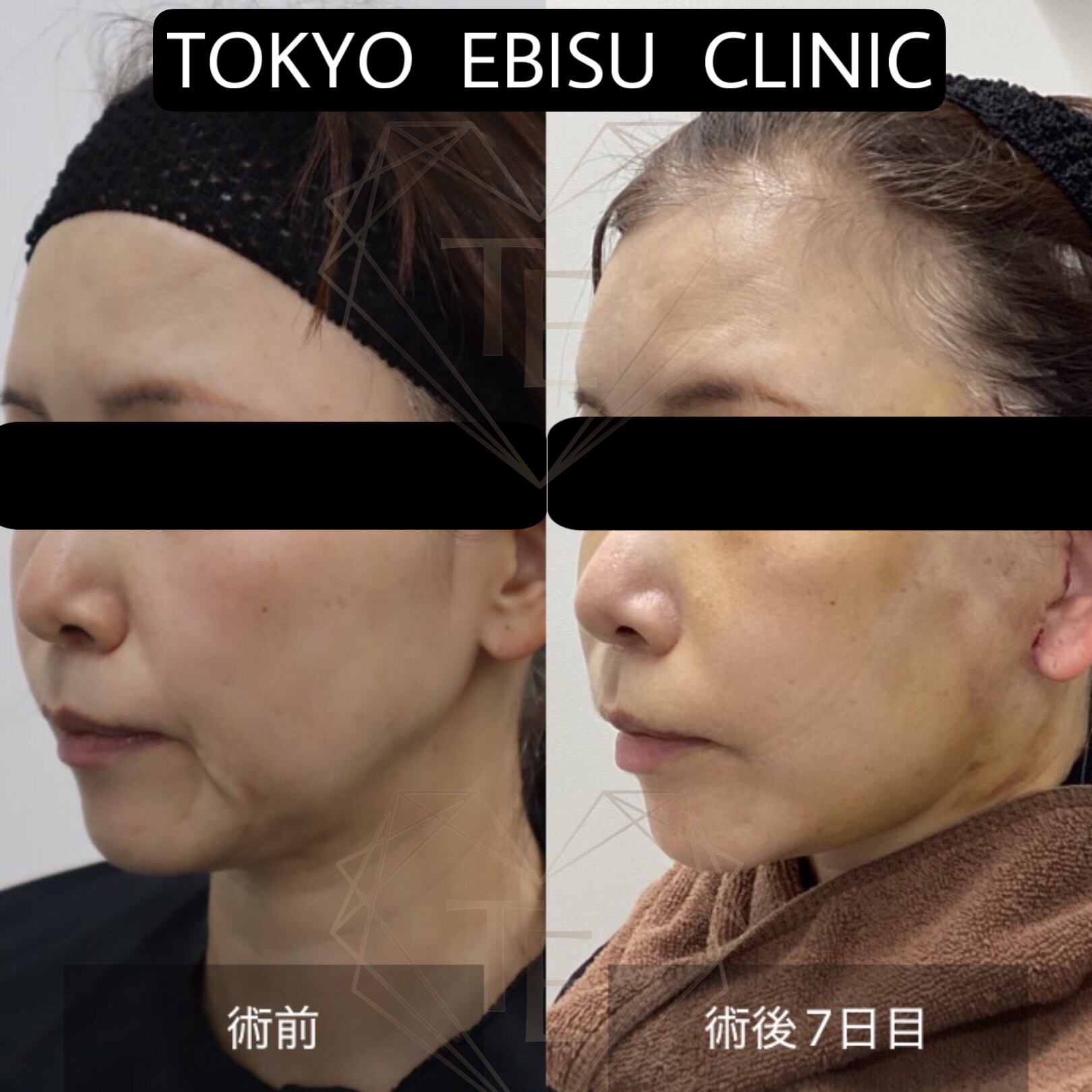 2d1c32cd-a9e4-462a-8ec0-d4806c70824c-1