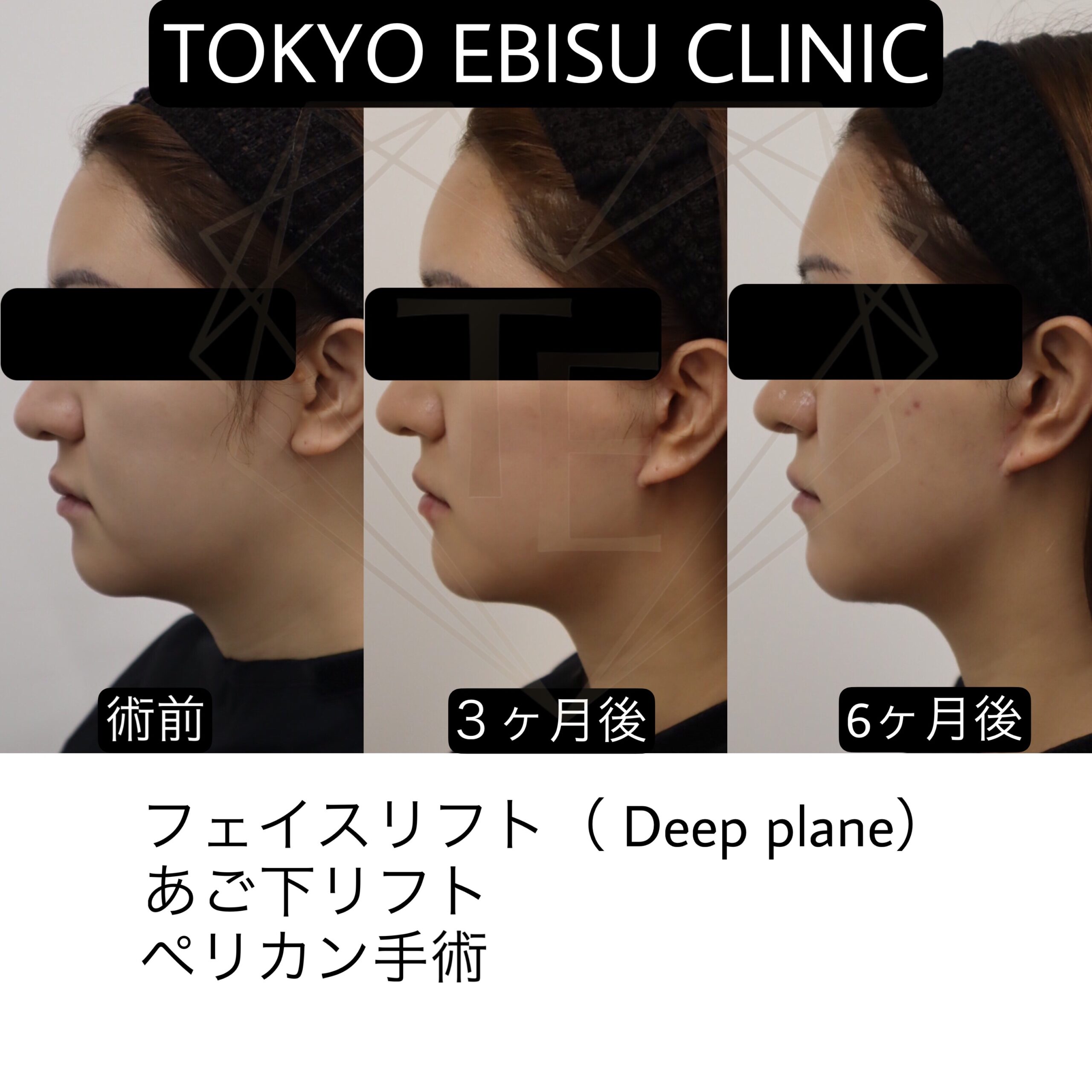 39568ec1-6e63-464d-bce9-353e1141087c-1-scaled