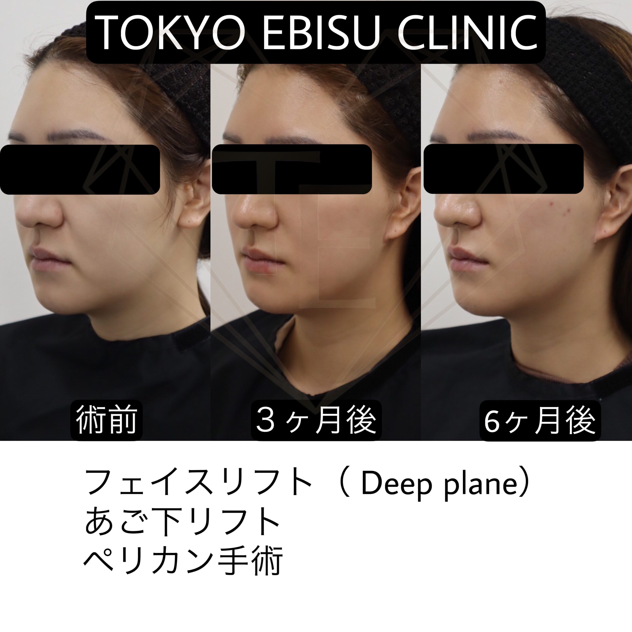 644beb07-5c19-4600-9548-7f88ef3f872e-1-scaled