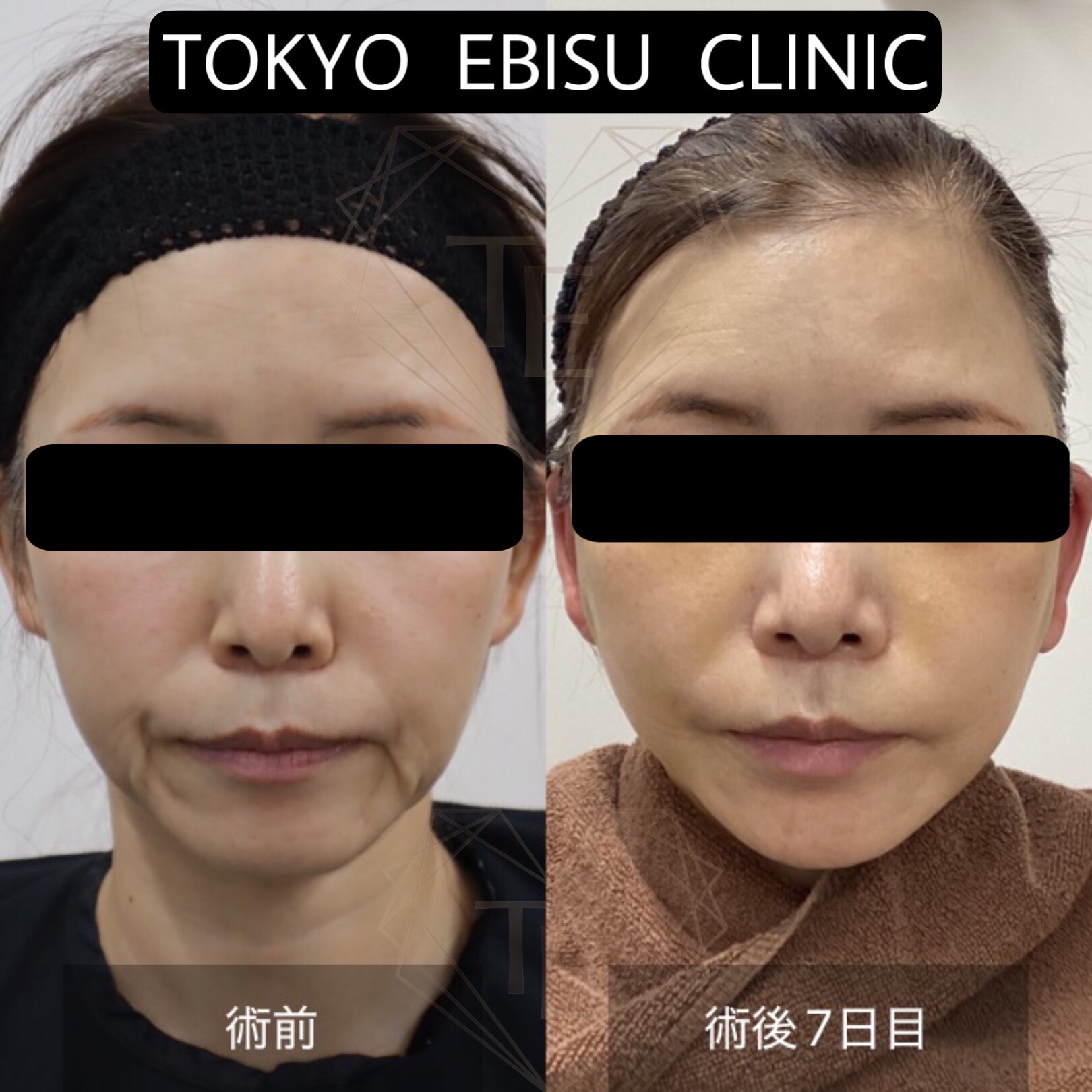 8894ddf9-0708-466e-ad55-661231f5d14f-1