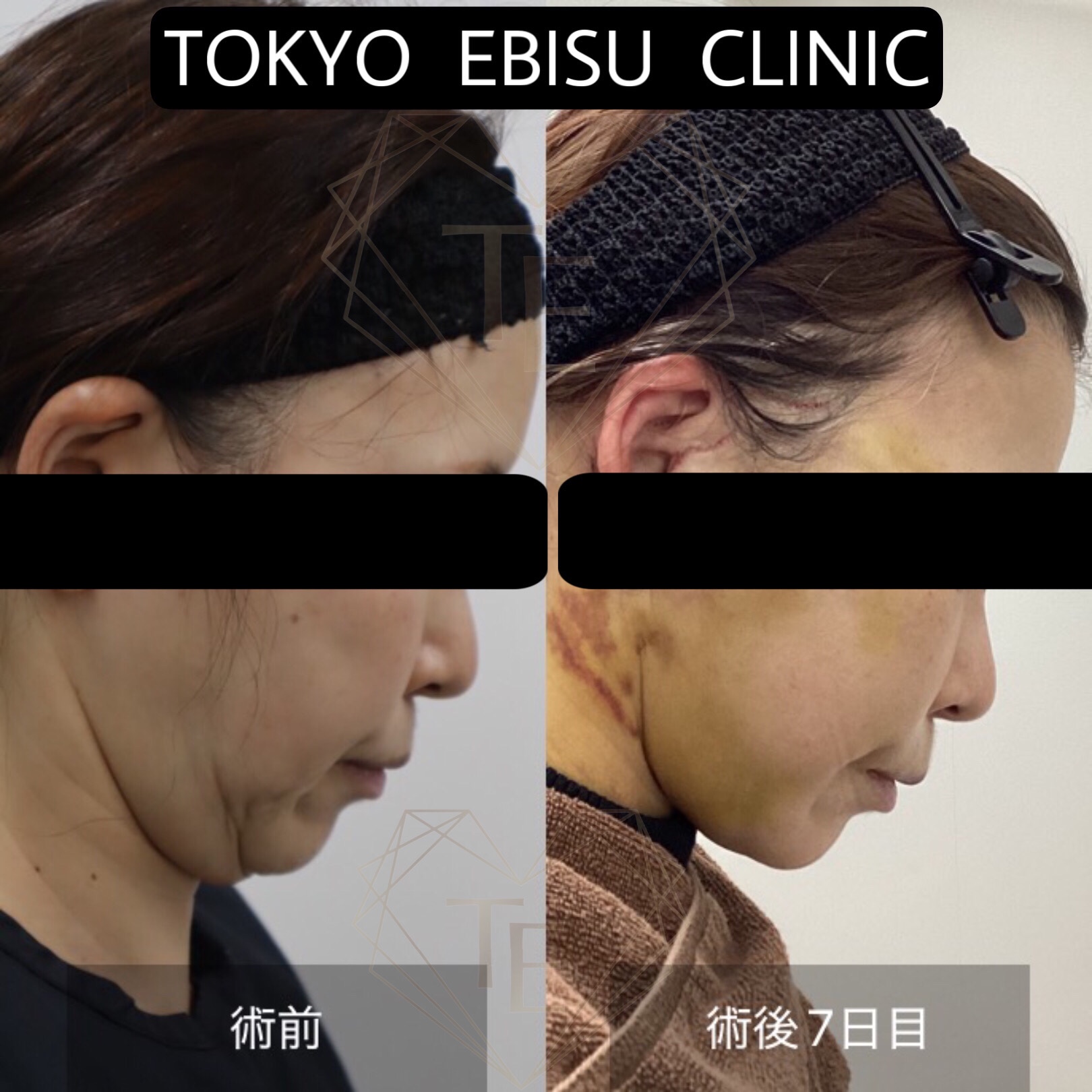 aab1d4f5-4224-4b59-acf5-64526bec0d35-1