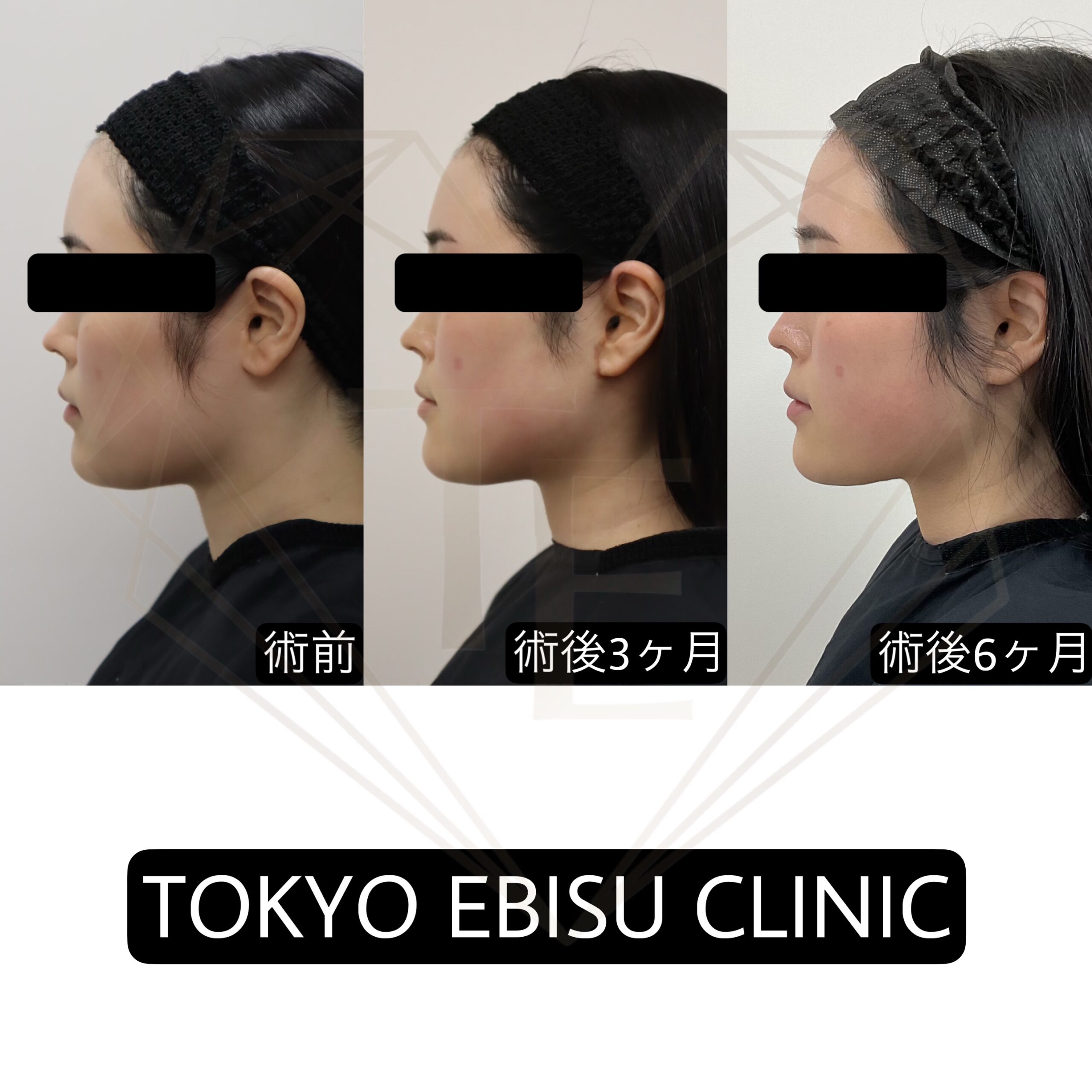 26679017-8ea7-4688-8807-06f6ba515f4c-1-scaled