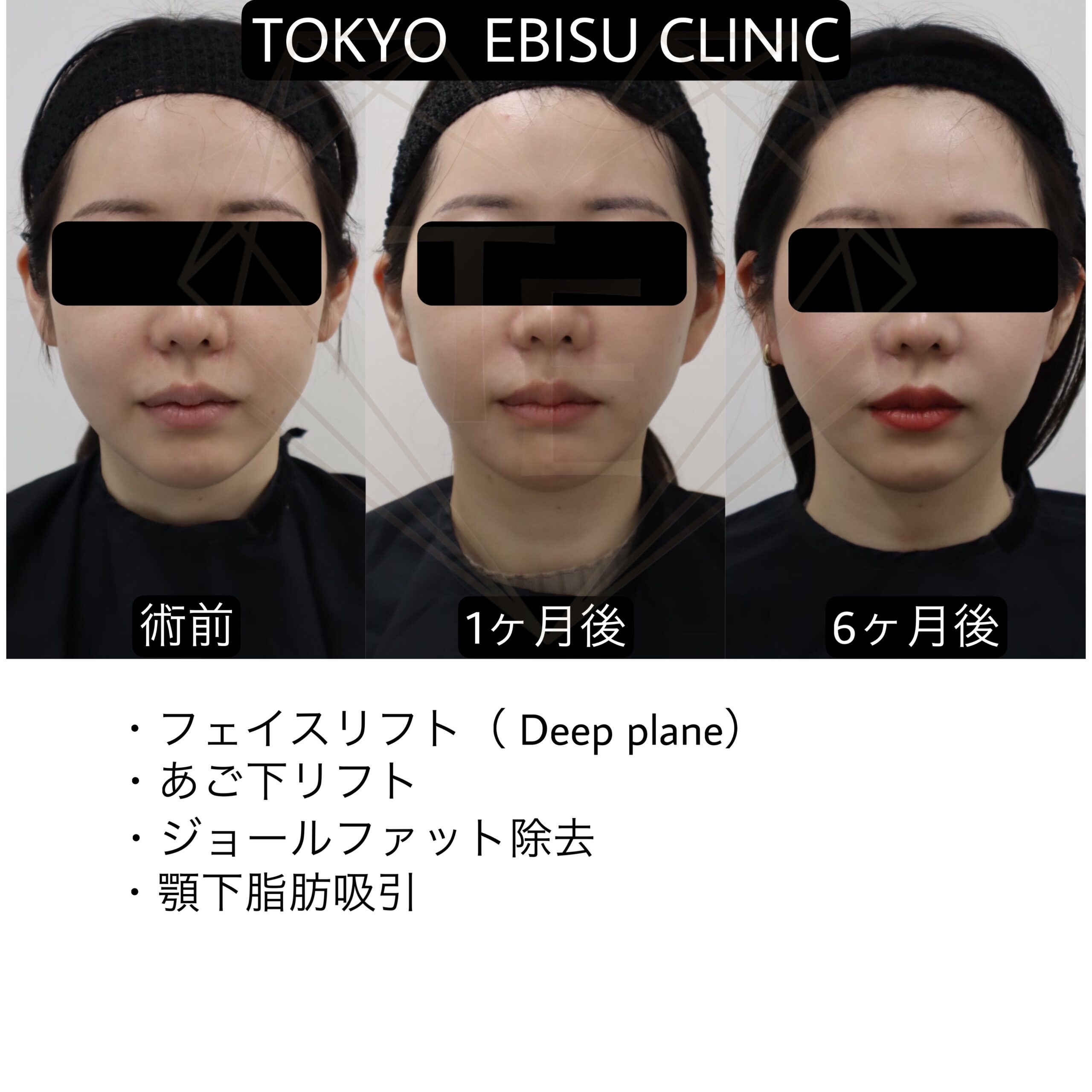46c49858-766e-4582-8046-baea17fb3c5f-1-scaled