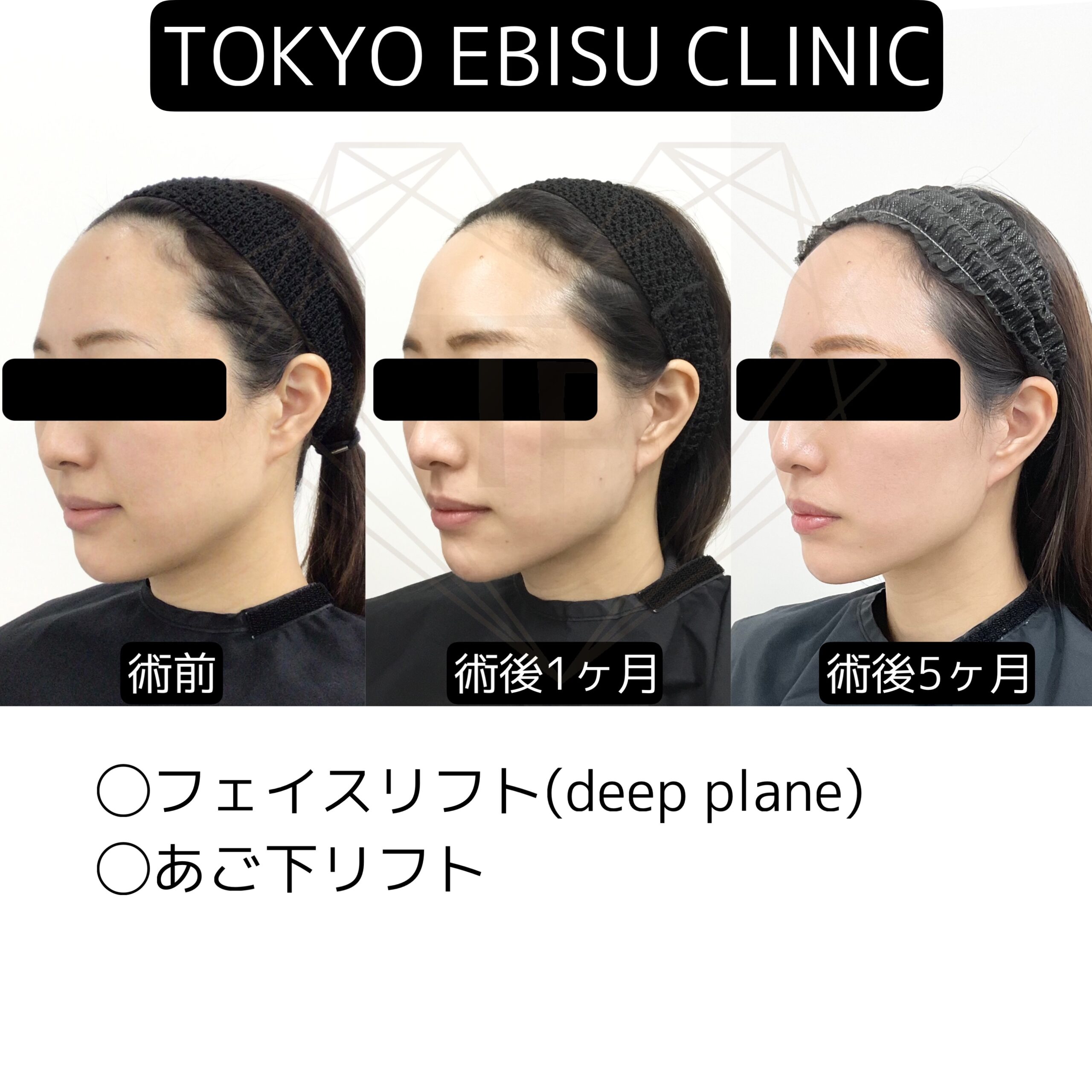 255b269d-b86d-424b-8b18-bea1711ae185-1-scaled