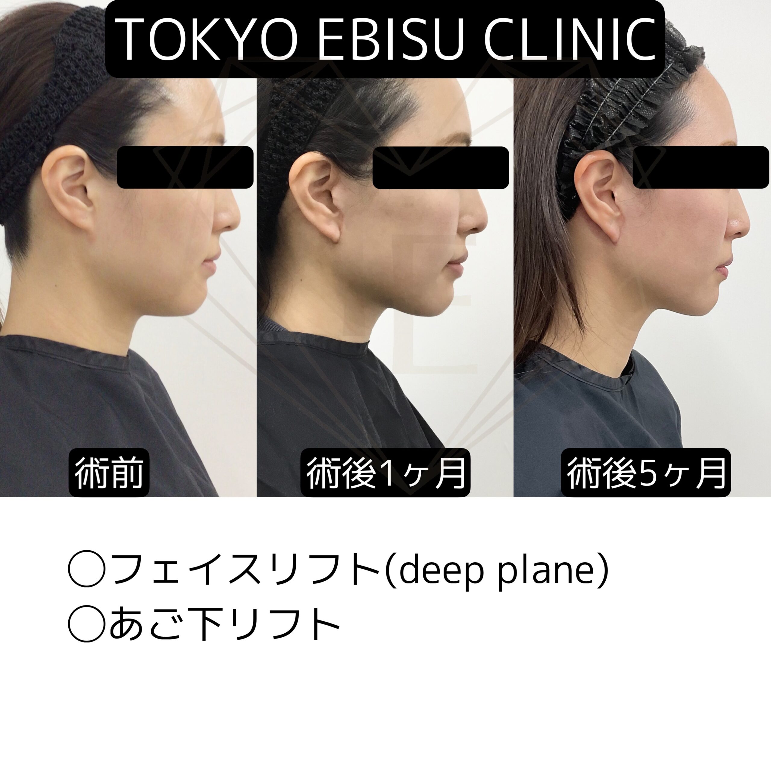 e9634d45-cab3-4c0c-bef6-e4fd7d67c1c0-1-scaled