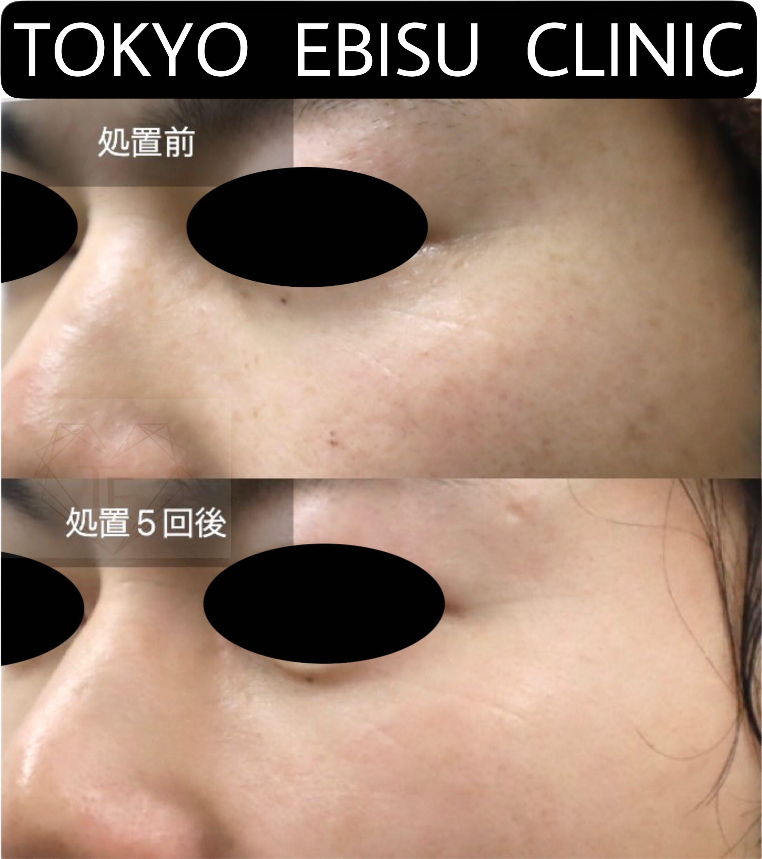 fc6854e627080ead02b80ab94160e911