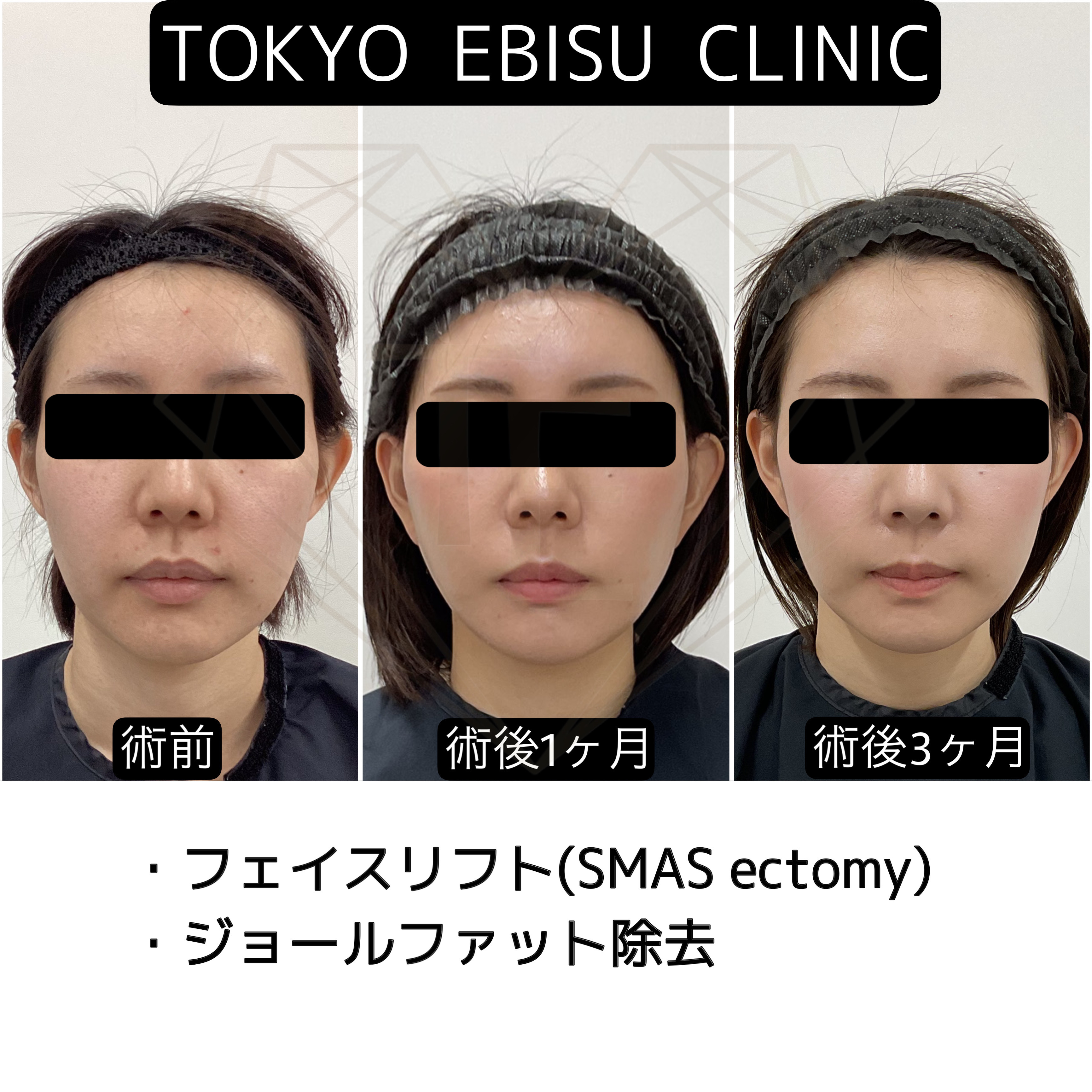 1E7CA080-99D7-4E73-88F9-8C15CA21A642
