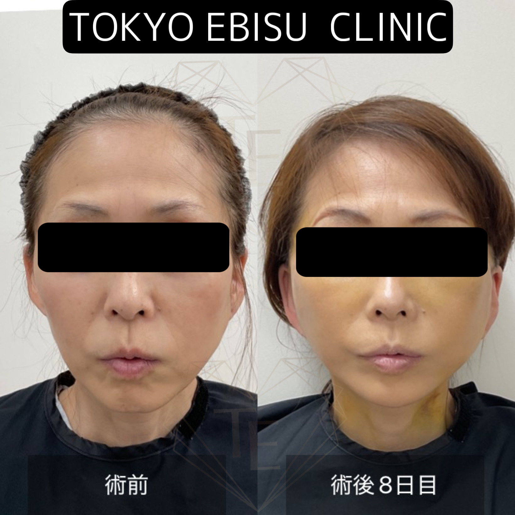 207eb60929a99bd77fdf4602d1a61bfe