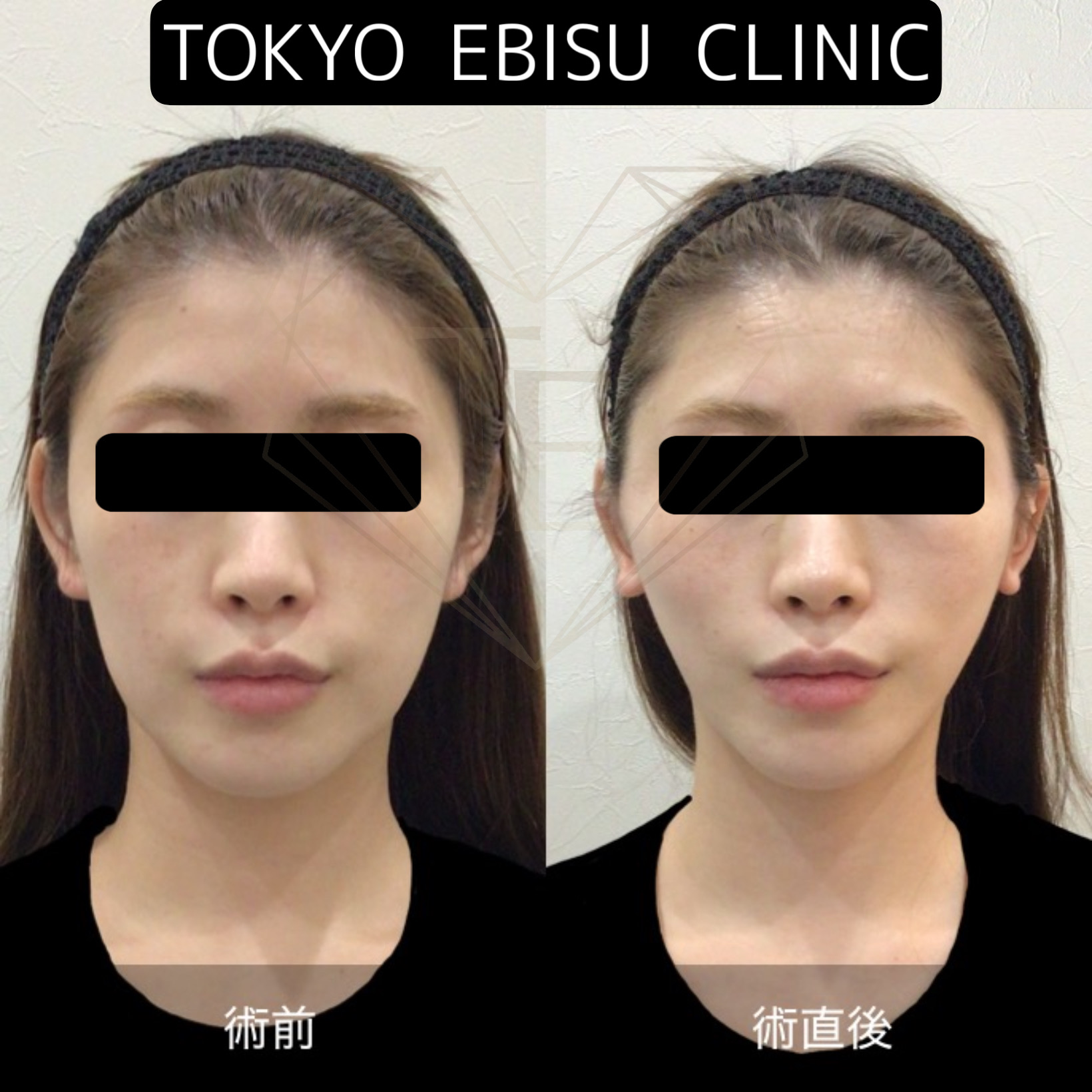 d55718127e51d79da04eb94dc30ae991