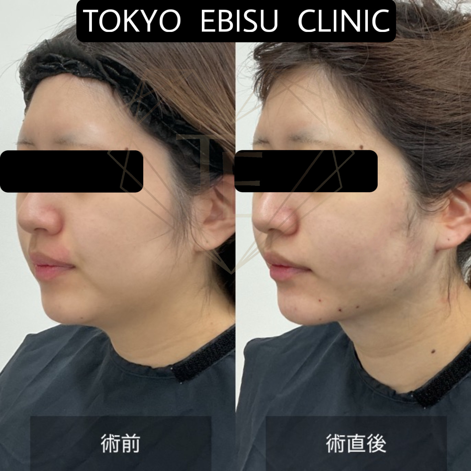 0a8664e28b039757e5055b99fcc936df