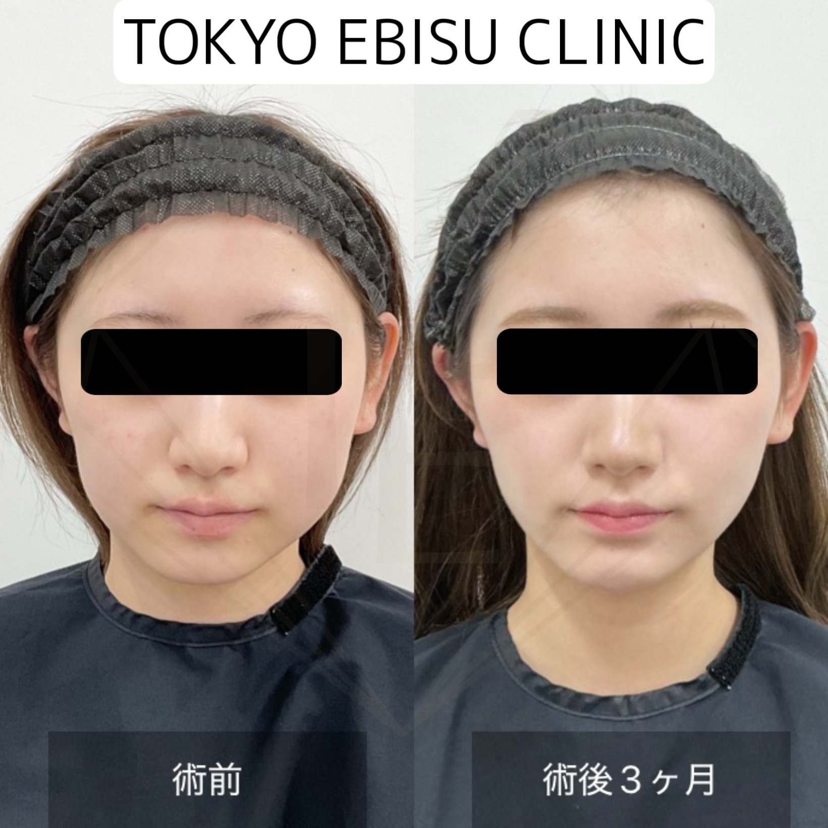 3ebf7433-5570-4ee1-a670-e7eb97afda8f