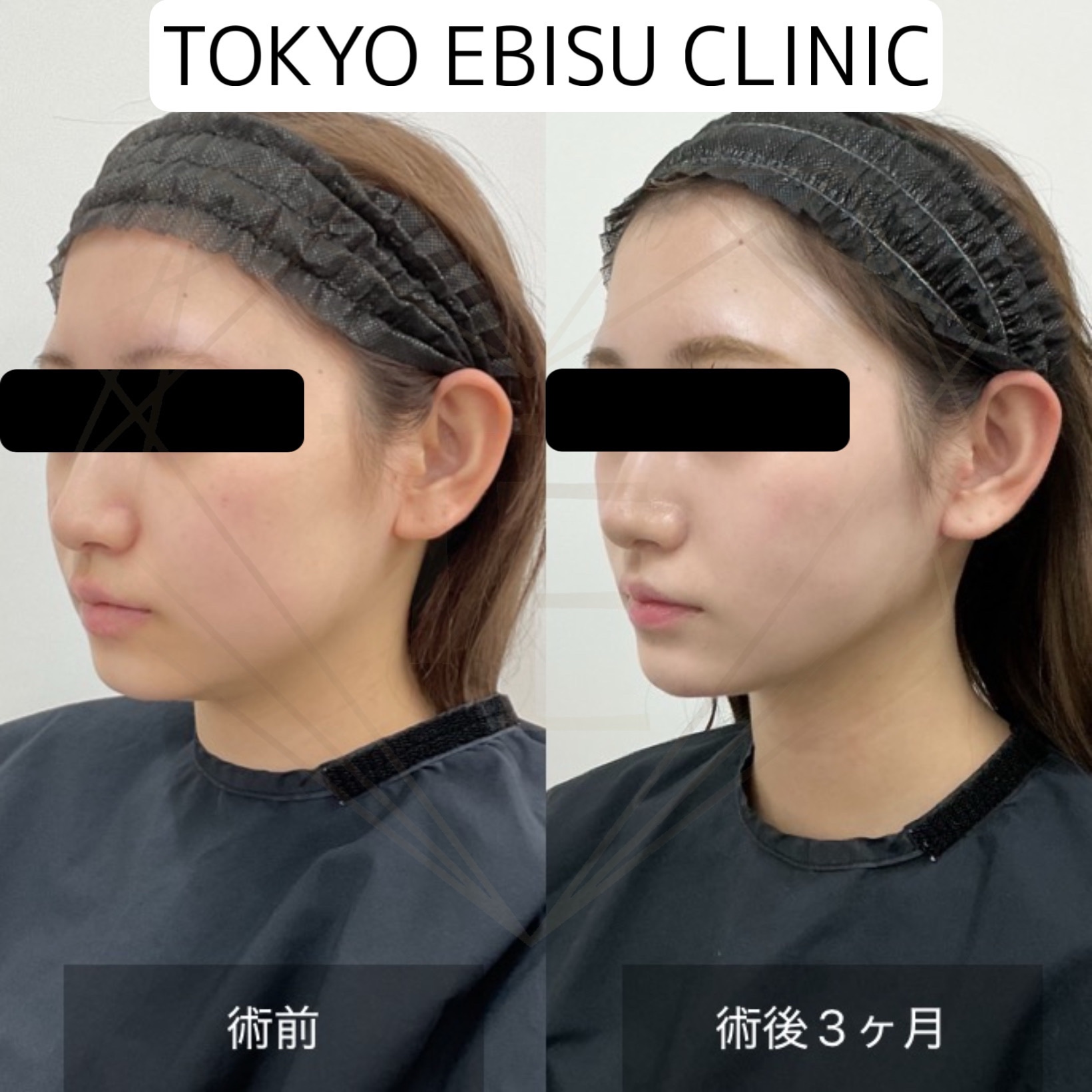 4387fdbf-db8f-4d54-b33e-b0c1d6ad7164