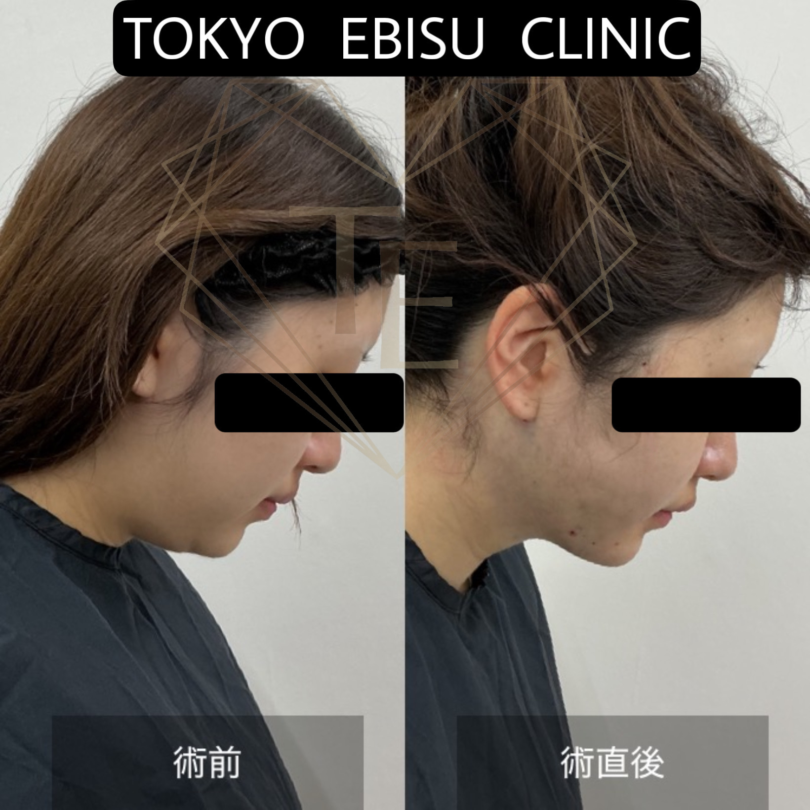 589c936a2a57b815b5f6eb1f7870eaeb