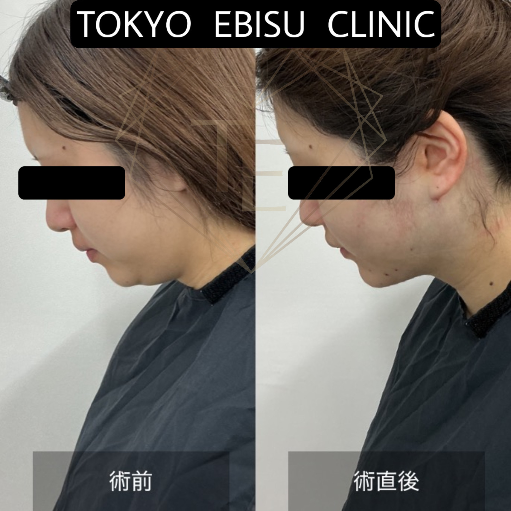 a9837a1bda307a9c9e51d0b386af1bcd