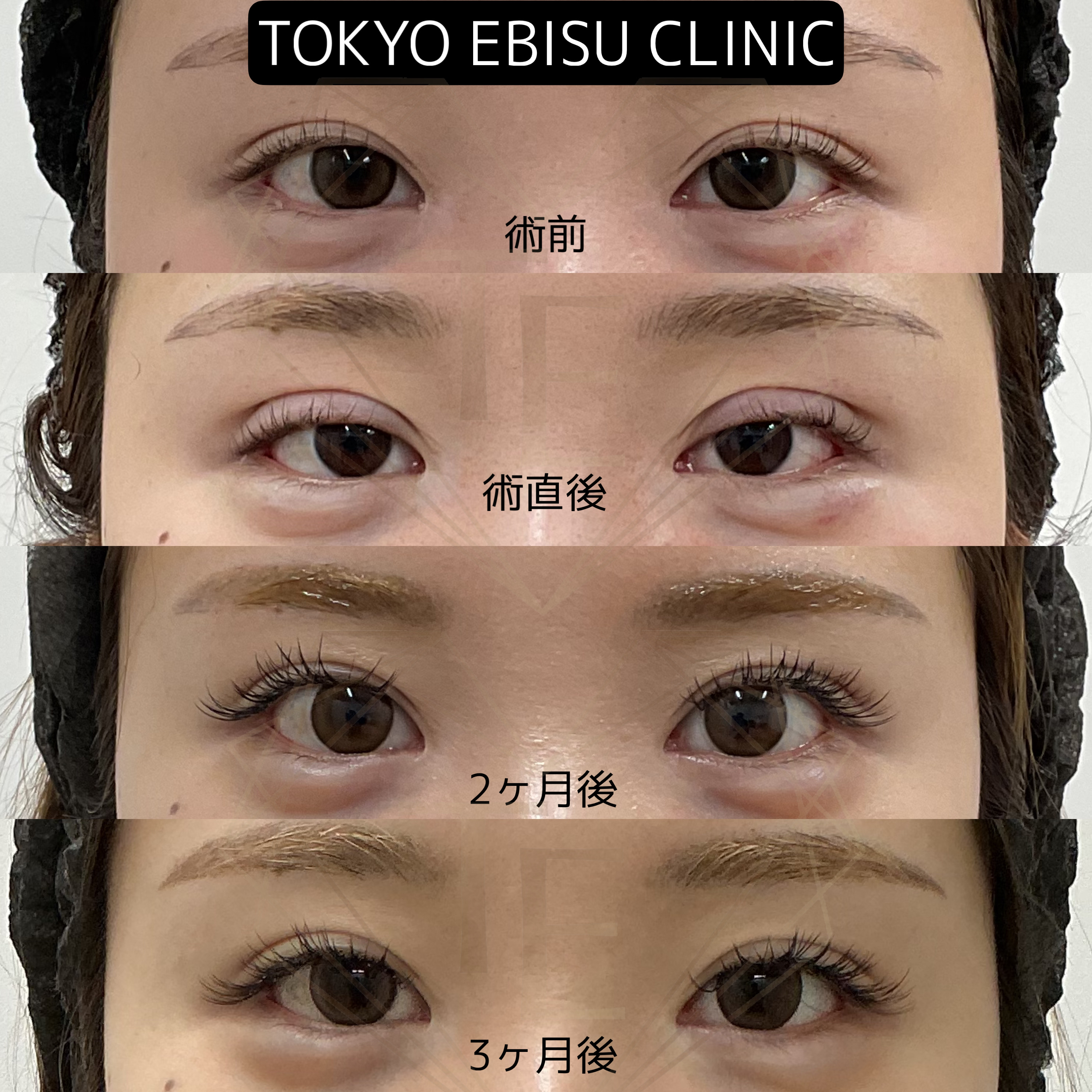 dcbe88e260b4ac204bc24ad10305ba58