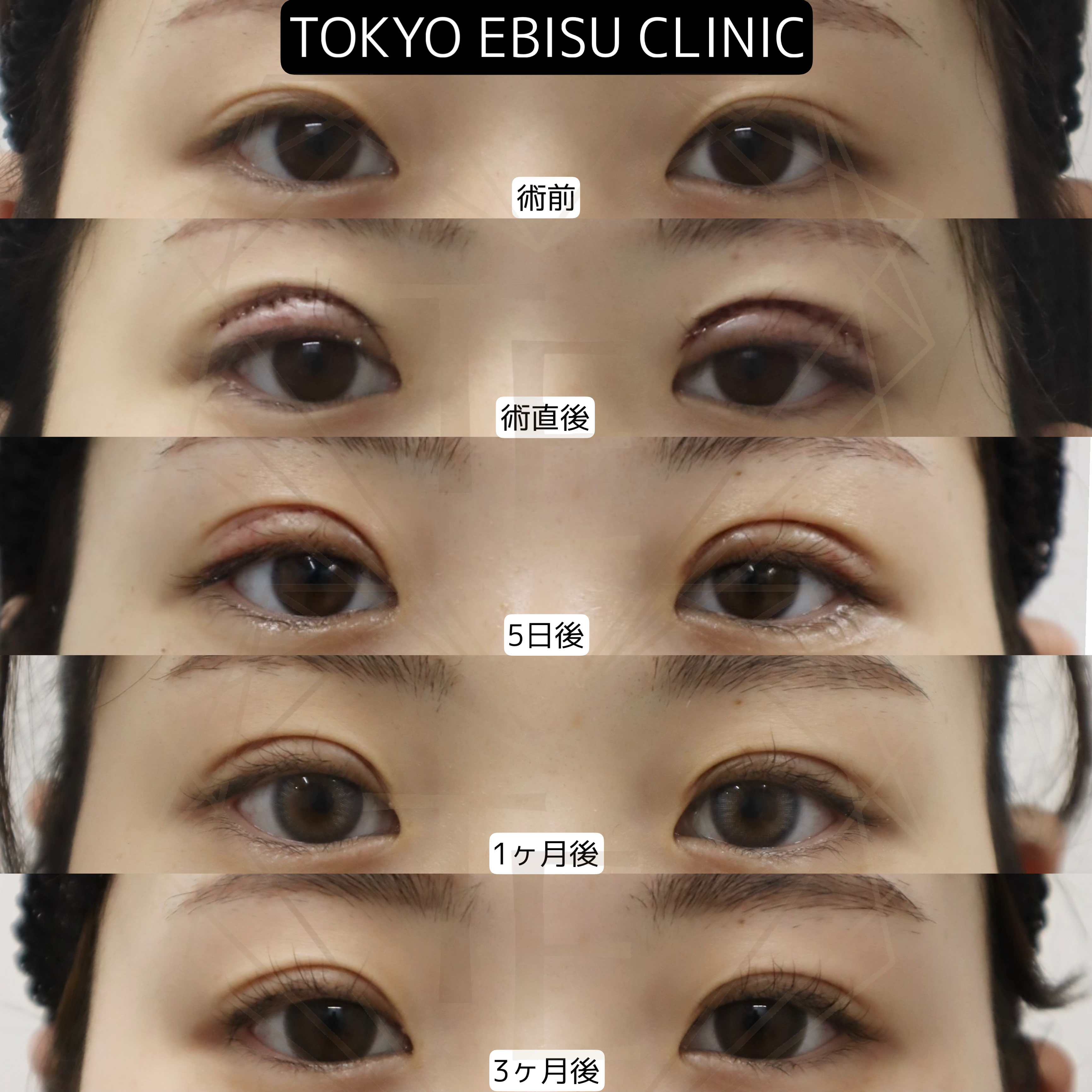 397f3743557da5f189a3274b961328ae