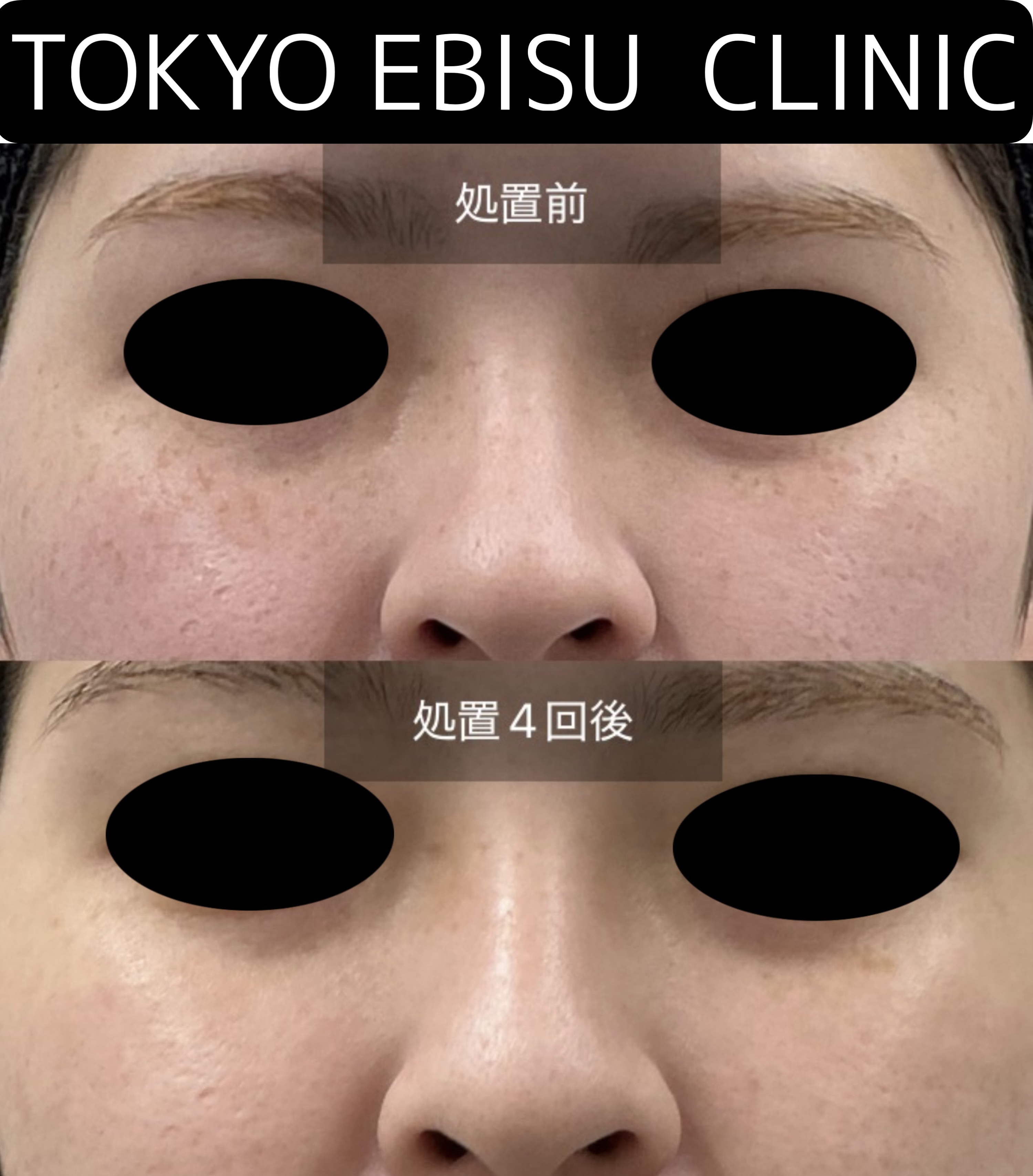 6A1E7D6E-CAB9-421B-82C4-48D4D9FB6C9F