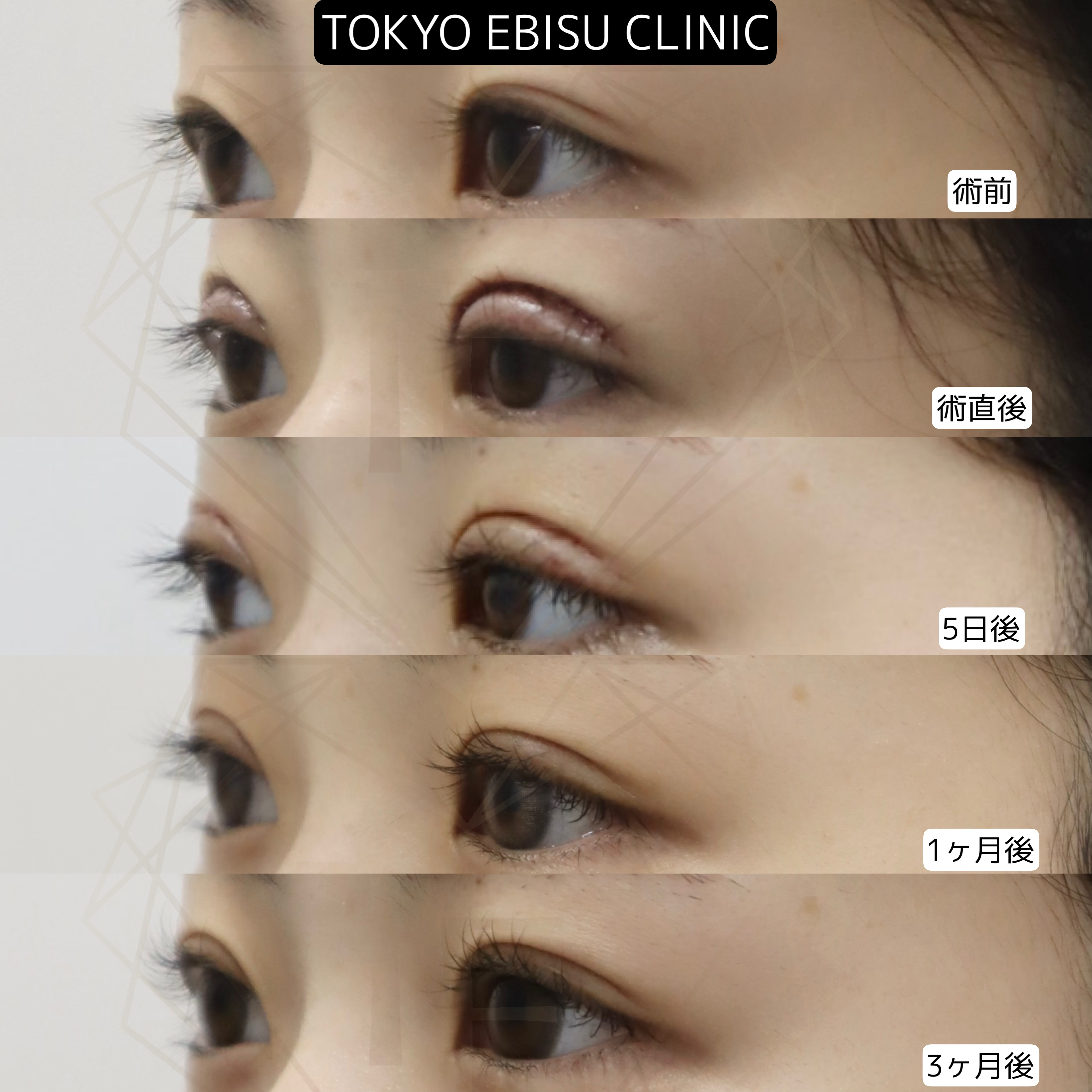 84b6f3db49e79751ae8fddd7f42e60f8