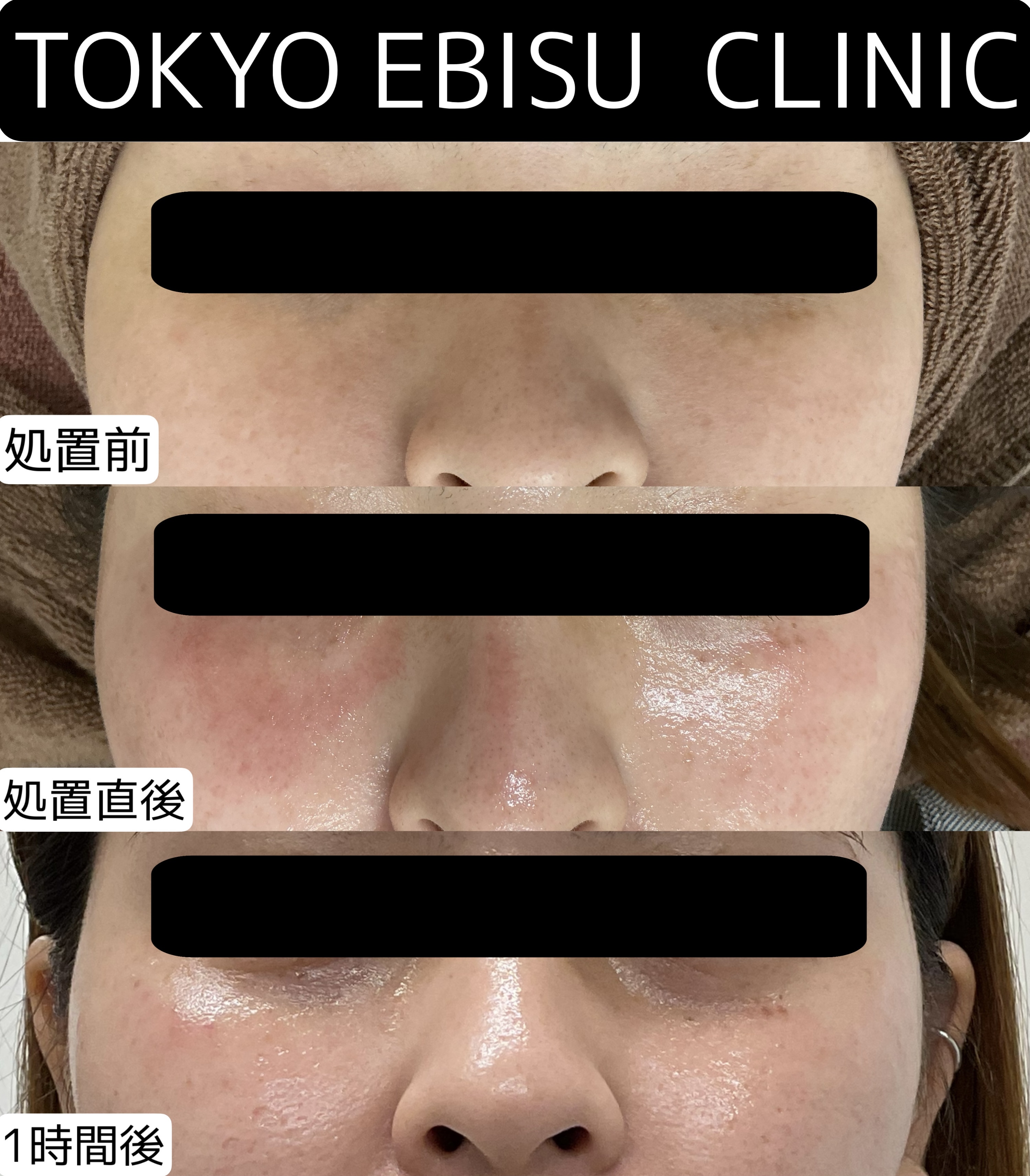 F01EFF3E-1665-4392-AAA2-0D2C71AF0154