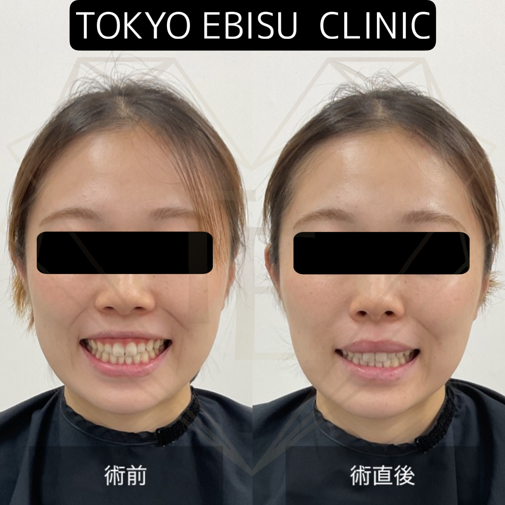 b74168d0b2bc5f1ac726af9f5796bbe1