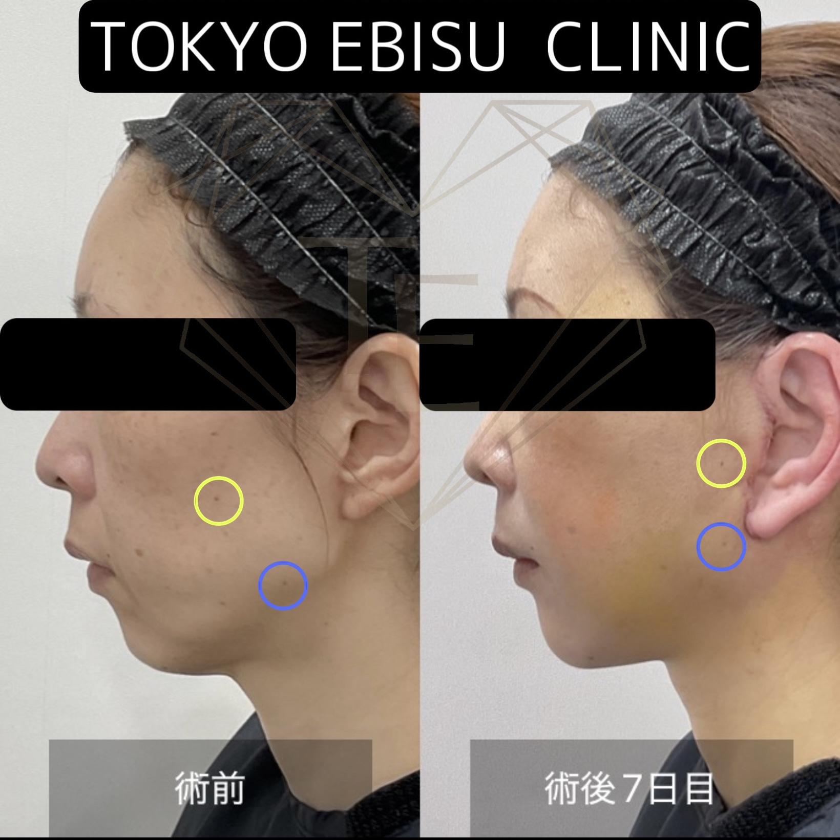 bc965743072a7cb0208f927028c5fd6d