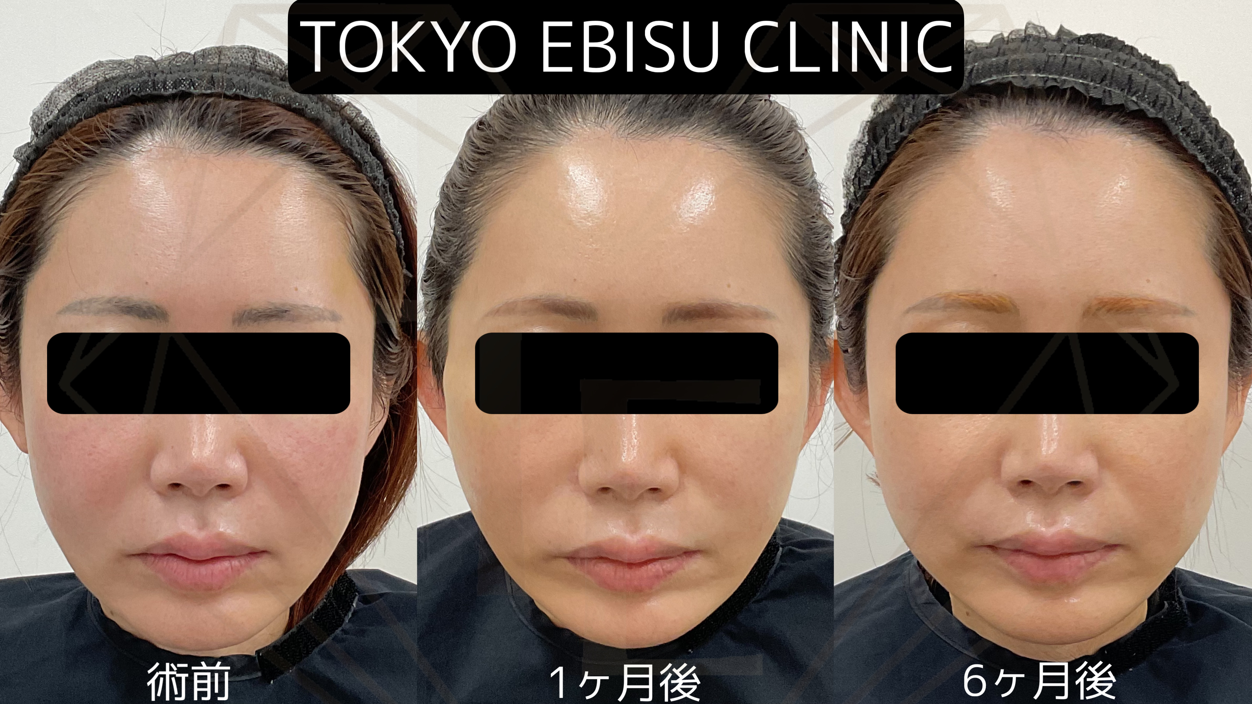 c0e1b09e1927f9c976e9449e8f5a412d