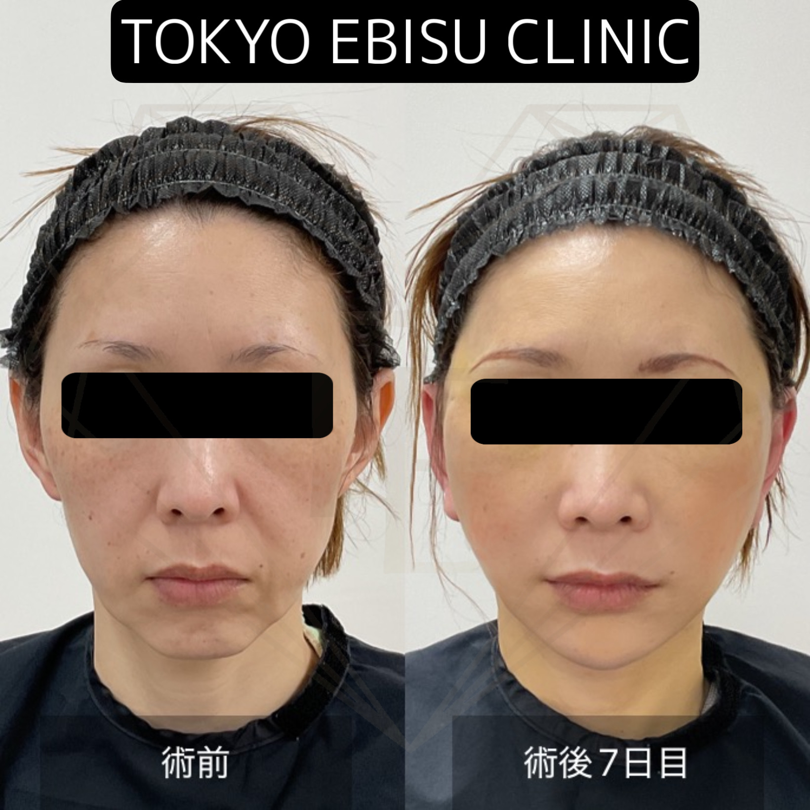 e9d0b8e1f09597a6e14be0cca431d0ea