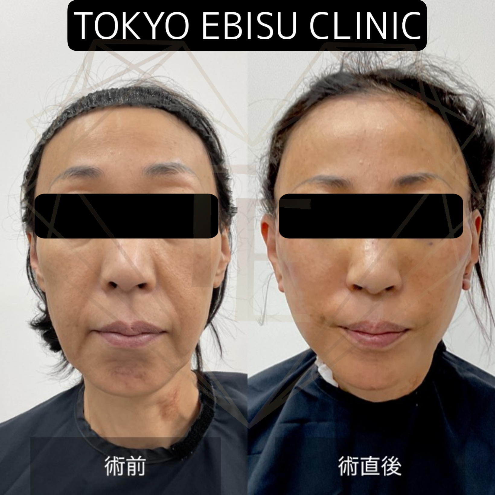 0b178d39f5c9a48b2eaa7fe9b1658091