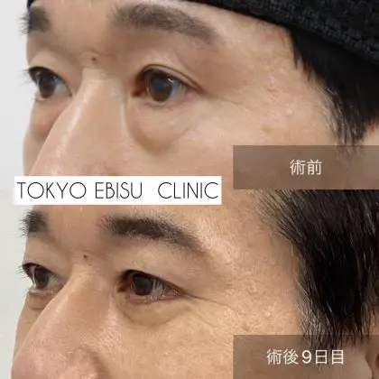 1F9BBFF2-7E87-4F69-8F50-32357BDD4D46-420x420-1