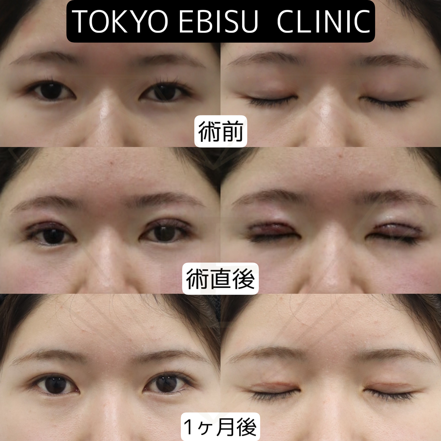 41E29393-8105-4E70-9819-FD93348A407D