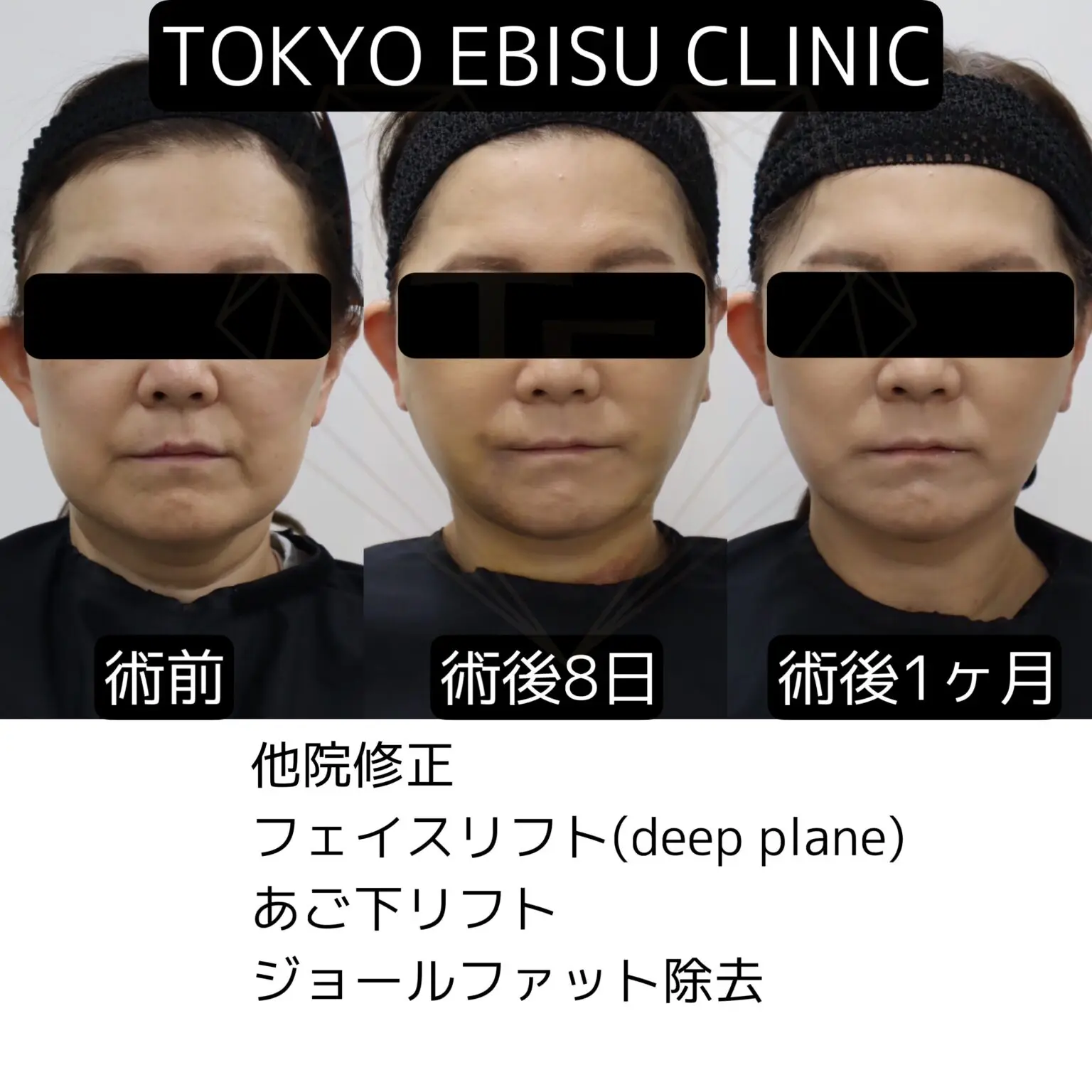 486e476a-1119-456a-b835-36ca1fe81b75-2-1-1536x1536-1