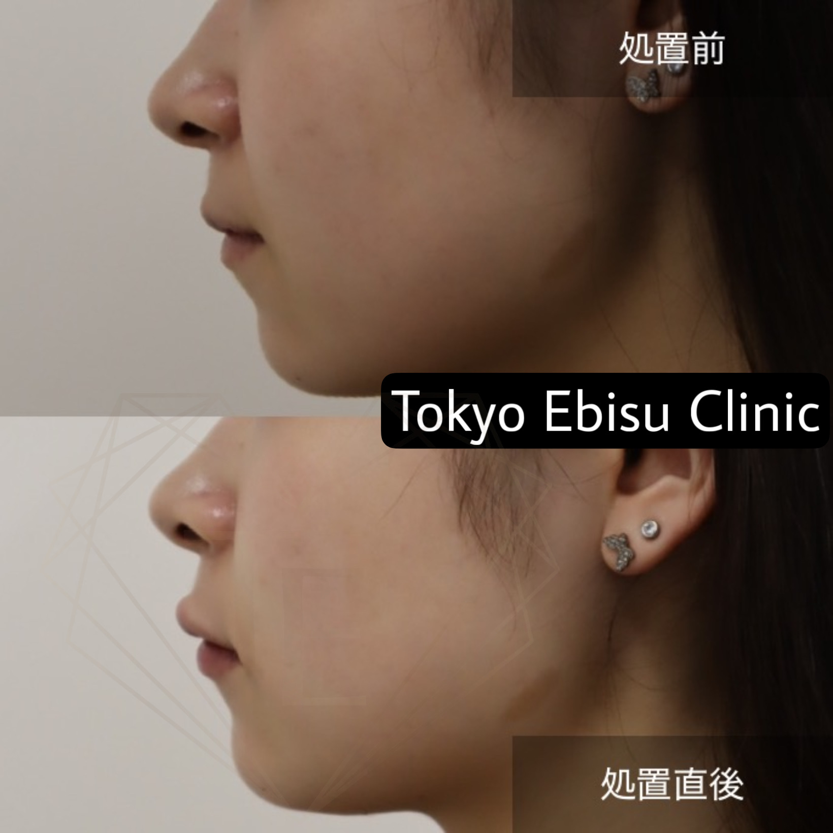 4b3d9cb0d72f308237b34ee7cb8d0664